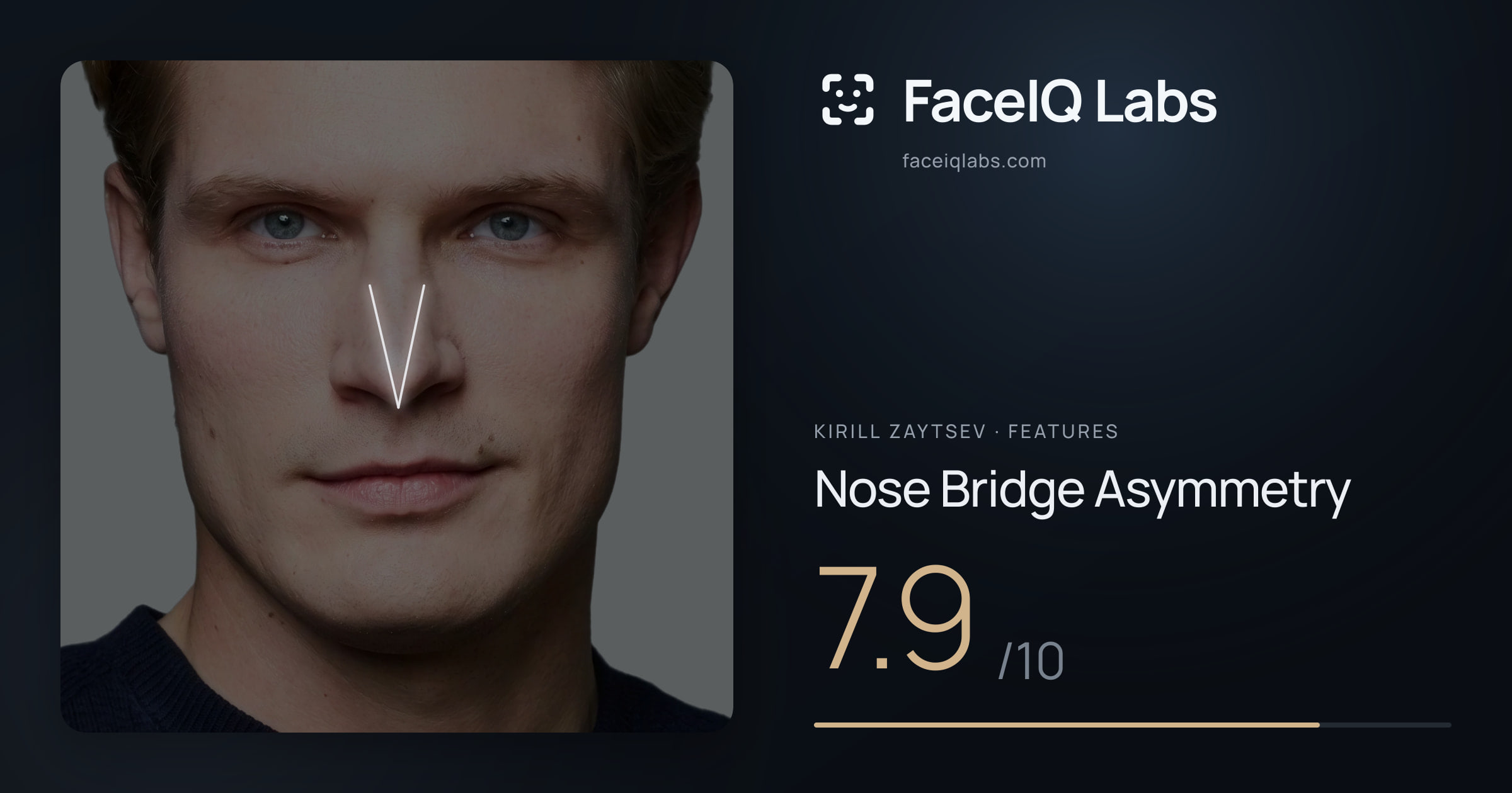 Kirill Zaytsev Nose Bridge Asymmetry: 7.9/10, drawn on the photo