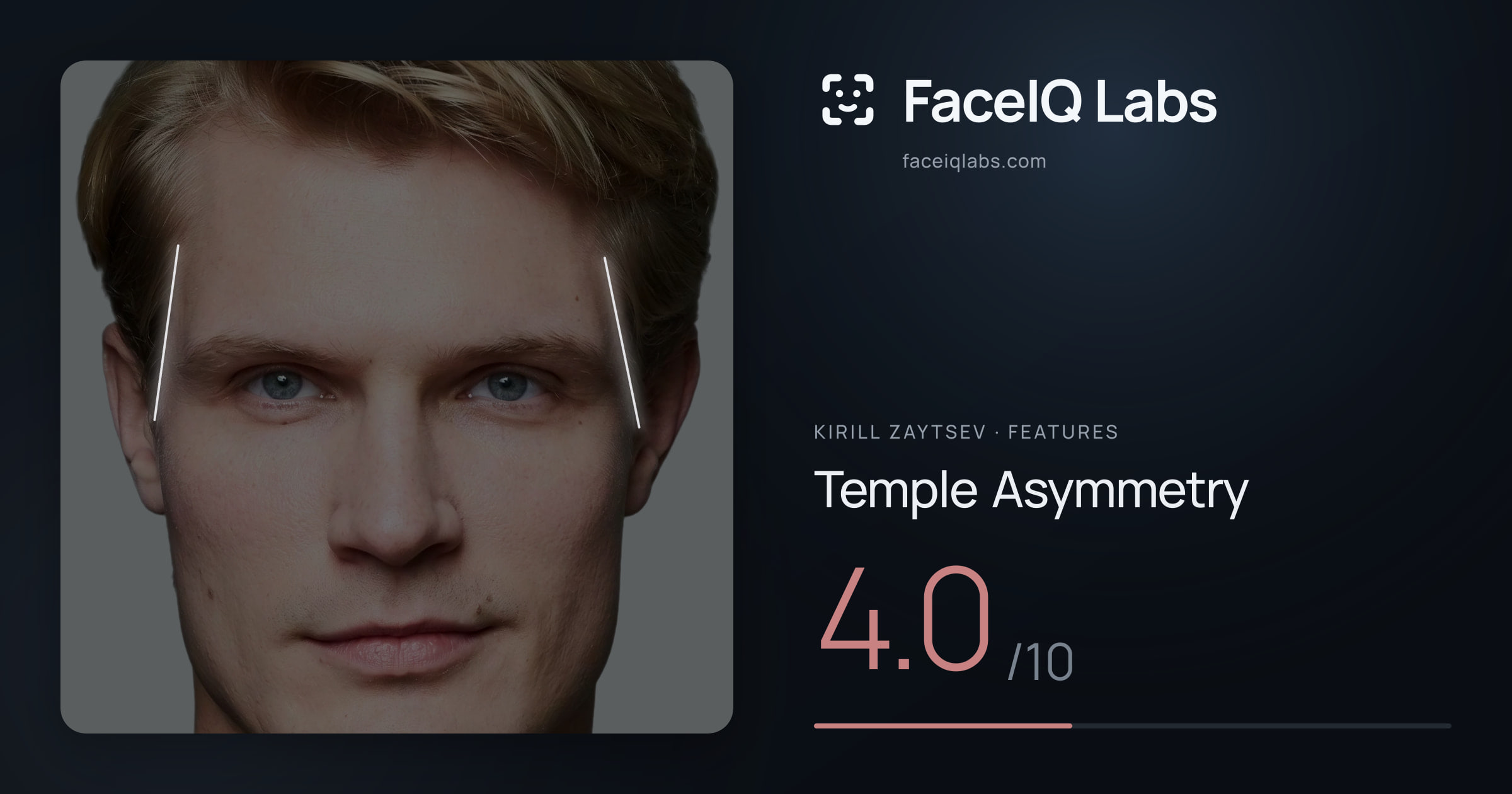 Kirill Zaytsev Temple Asymmetry: 4.0/10, drawn on the photo