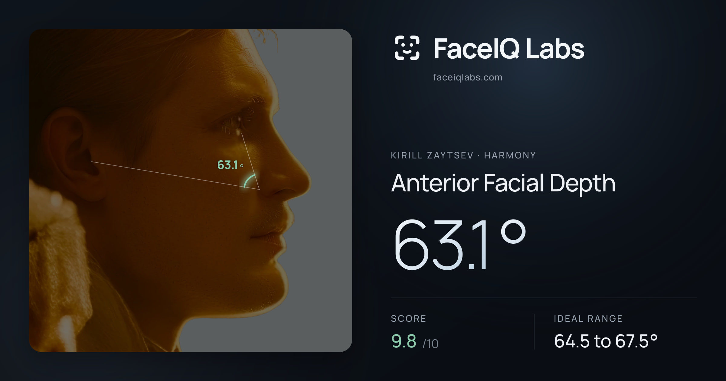 Kirill Zaytsev Anterior Facial Depth: 63.1°, drawn on the photo