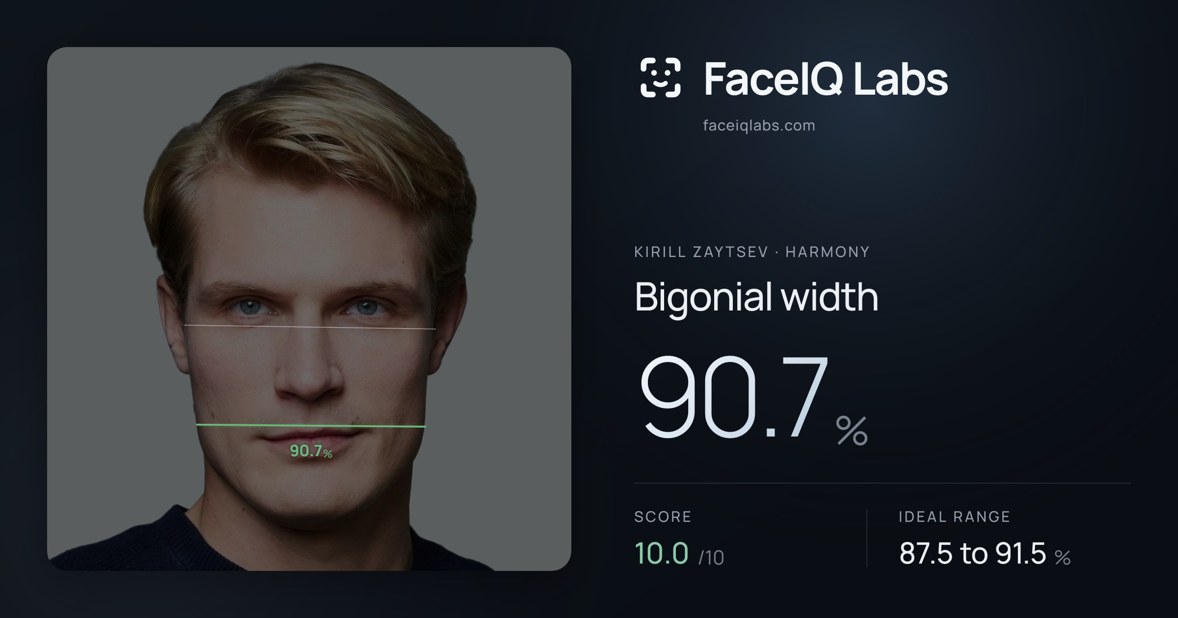 Kirill Zaytsev Bigonial width: 90.7%, drawn on the photo