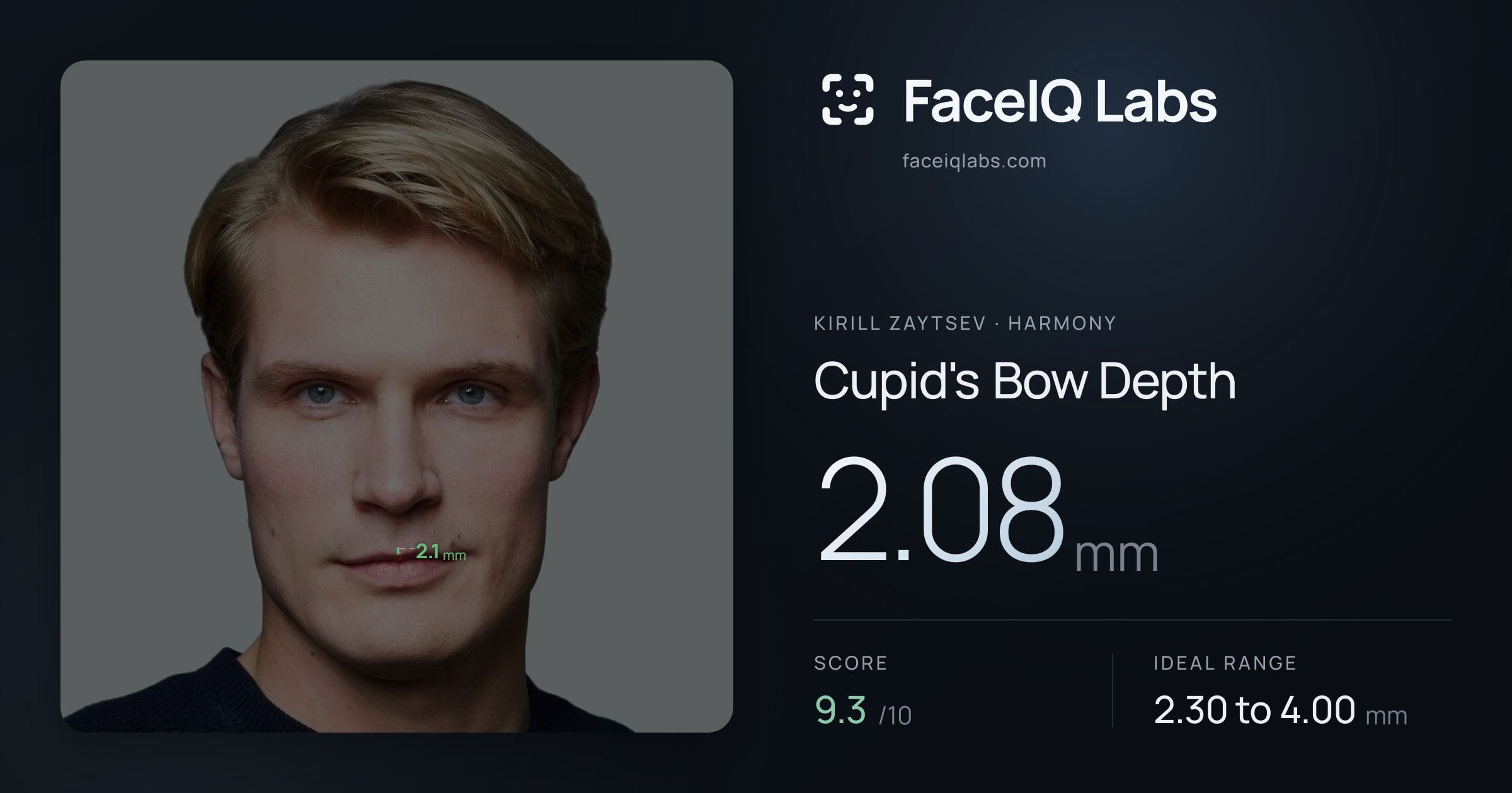 Kirill Zaytsev Cupid's Bow Depth: 2.08mm, drawn on the photo