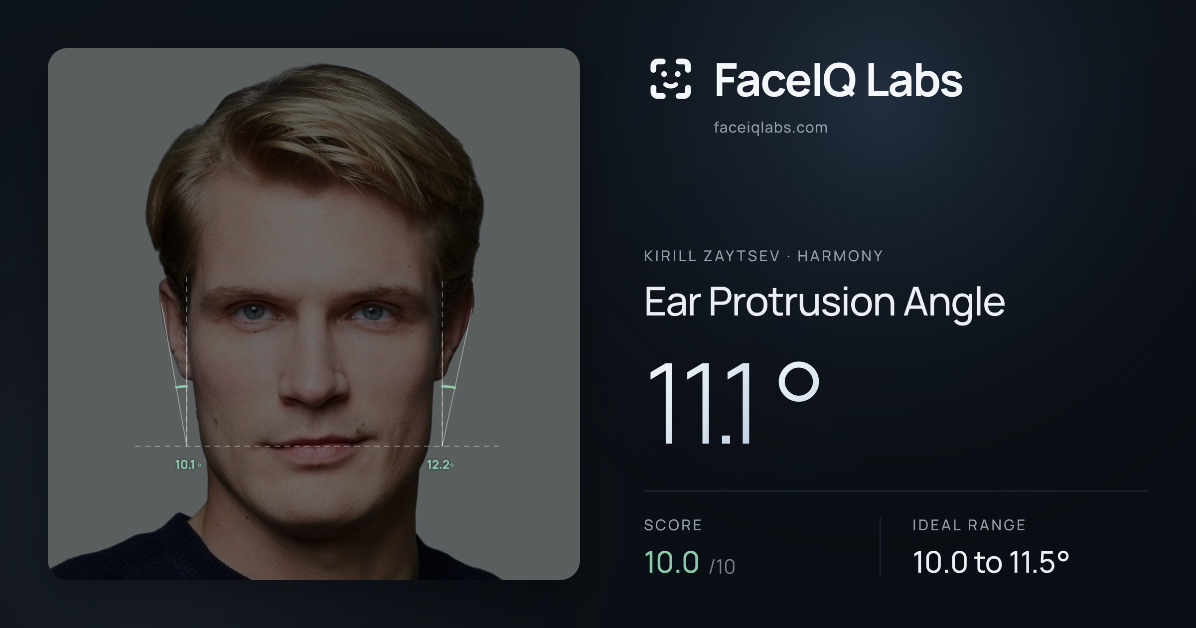 Kirill Zaytsev Ear Protrusion Angle: 11.1°, drawn on the photo