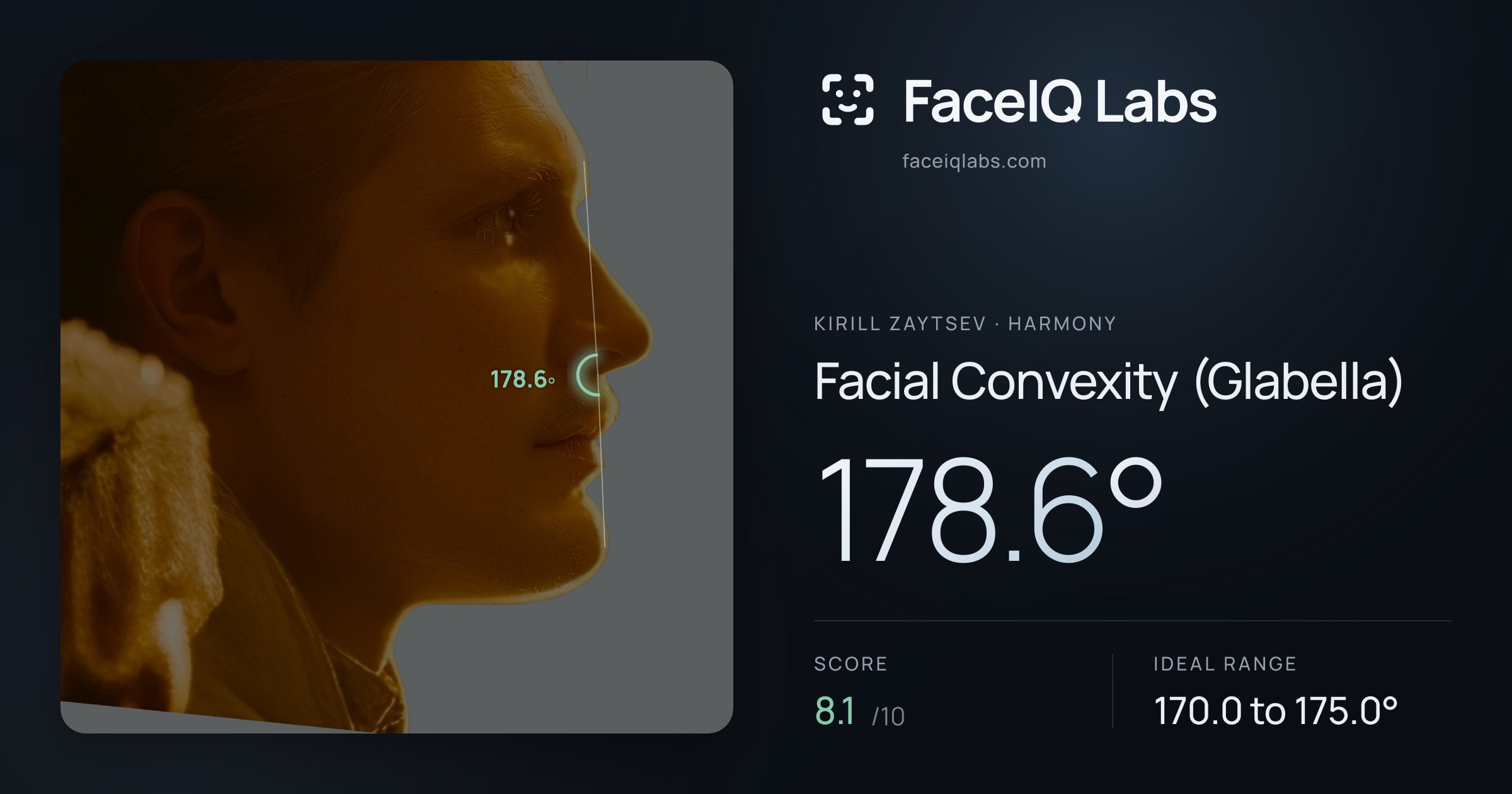 Kirill Zaytsev Facial Convexity (Glabella): 178.6°, drawn on the photo