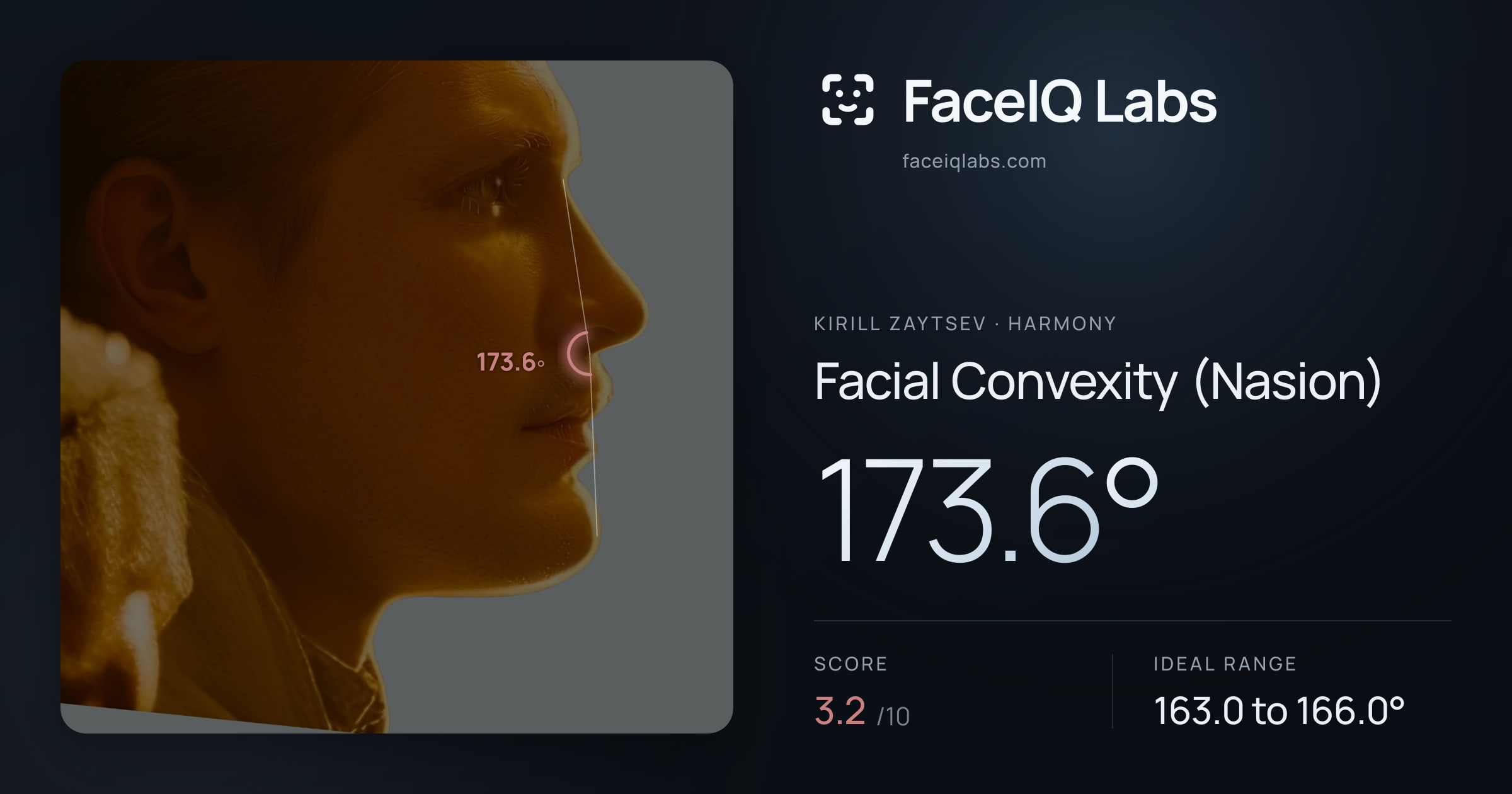 Kirill Zaytsev Facial Convexity (Nasion): 173.6°, drawn on the photo