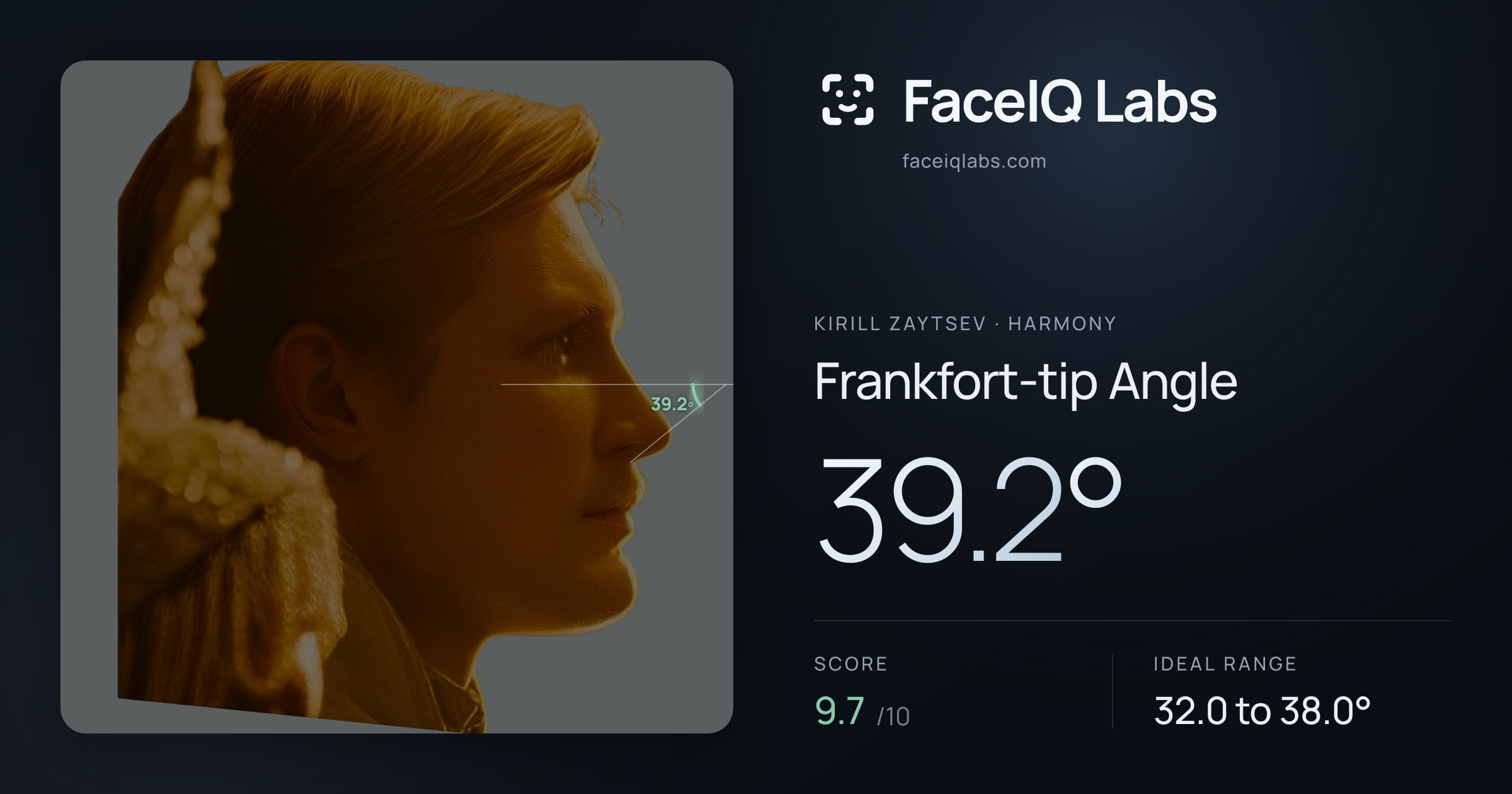 Kirill Zaytsev Frankfort-tip Angle: 39.2°, drawn on the photo