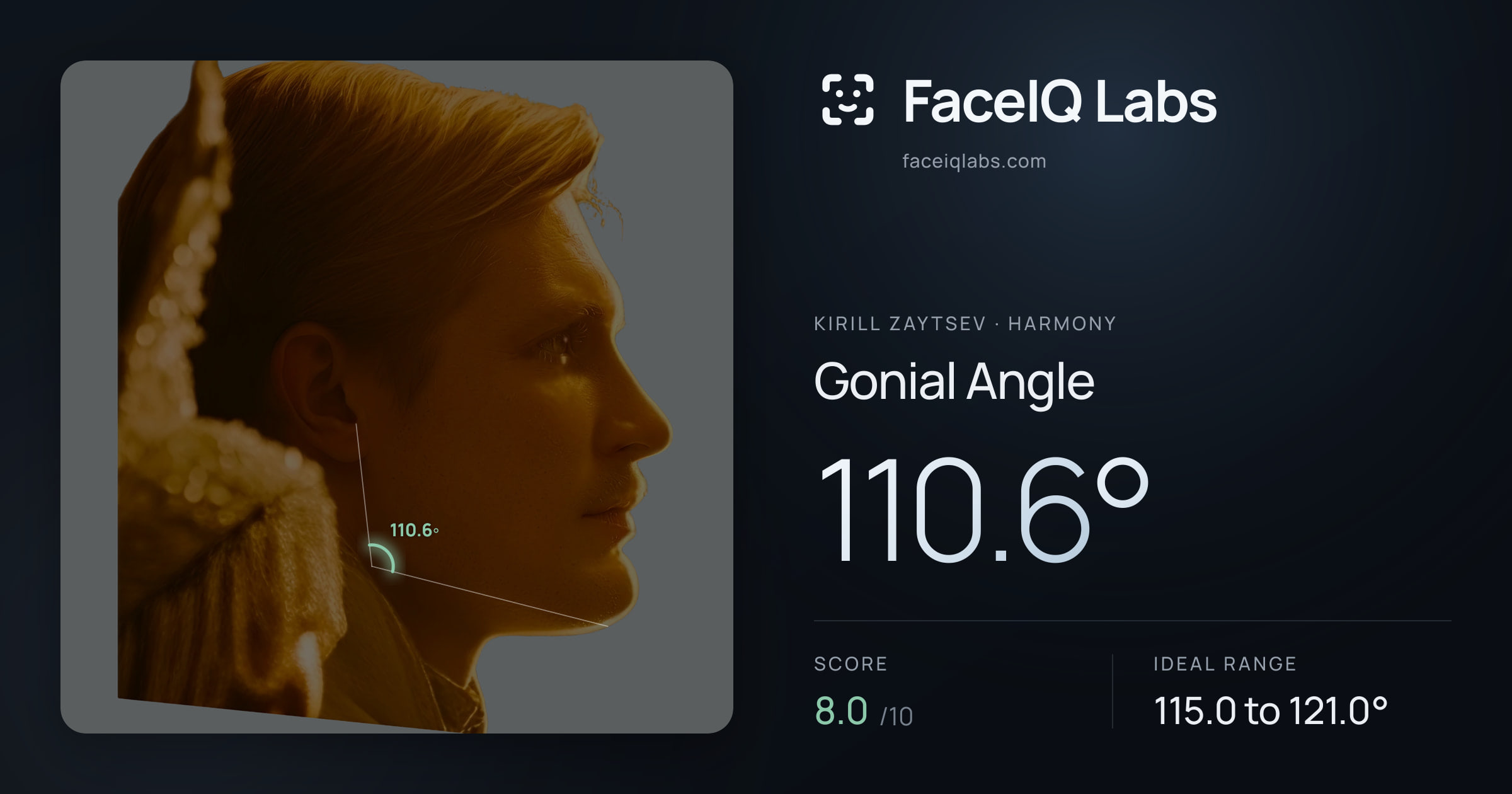 Kirill Zaytsev Gonial Angle: 110.6°, drawn on the photo