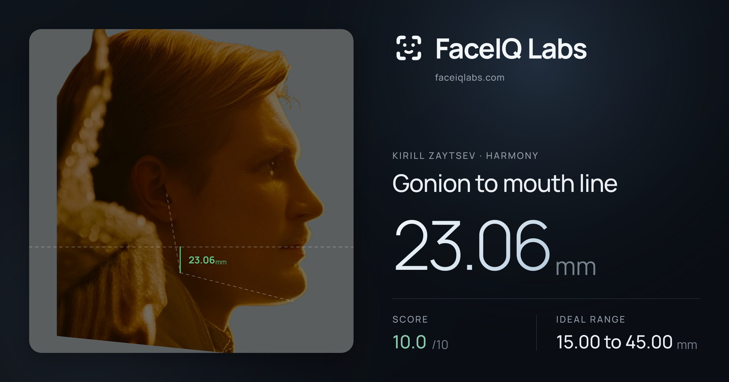 Kirill Zaytsev Gonion to mouth line: 23.06mm, drawn on the photo