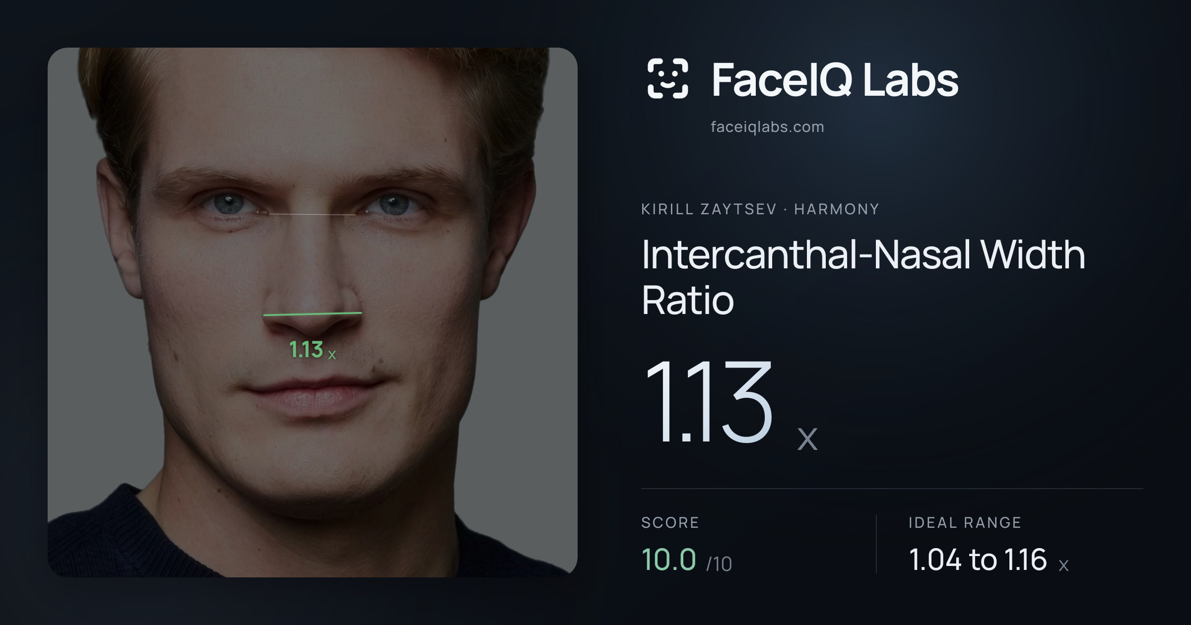Kirill Zaytsev Intercanthal-Nasal Width Ratio: 1.13x, drawn on the photo