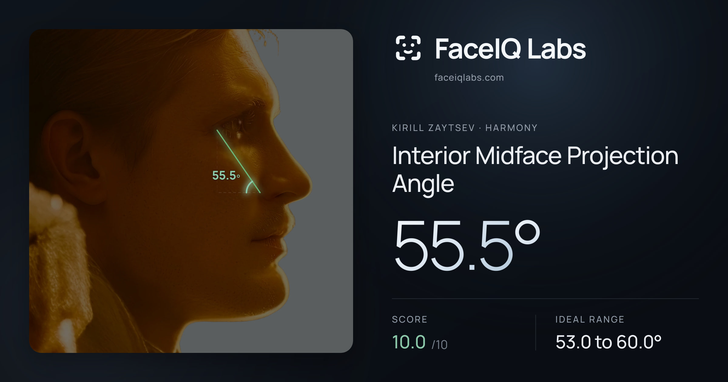 Kirill Zaytsev Interior Midface Projection Angle: 55.5°, drawn on the photo