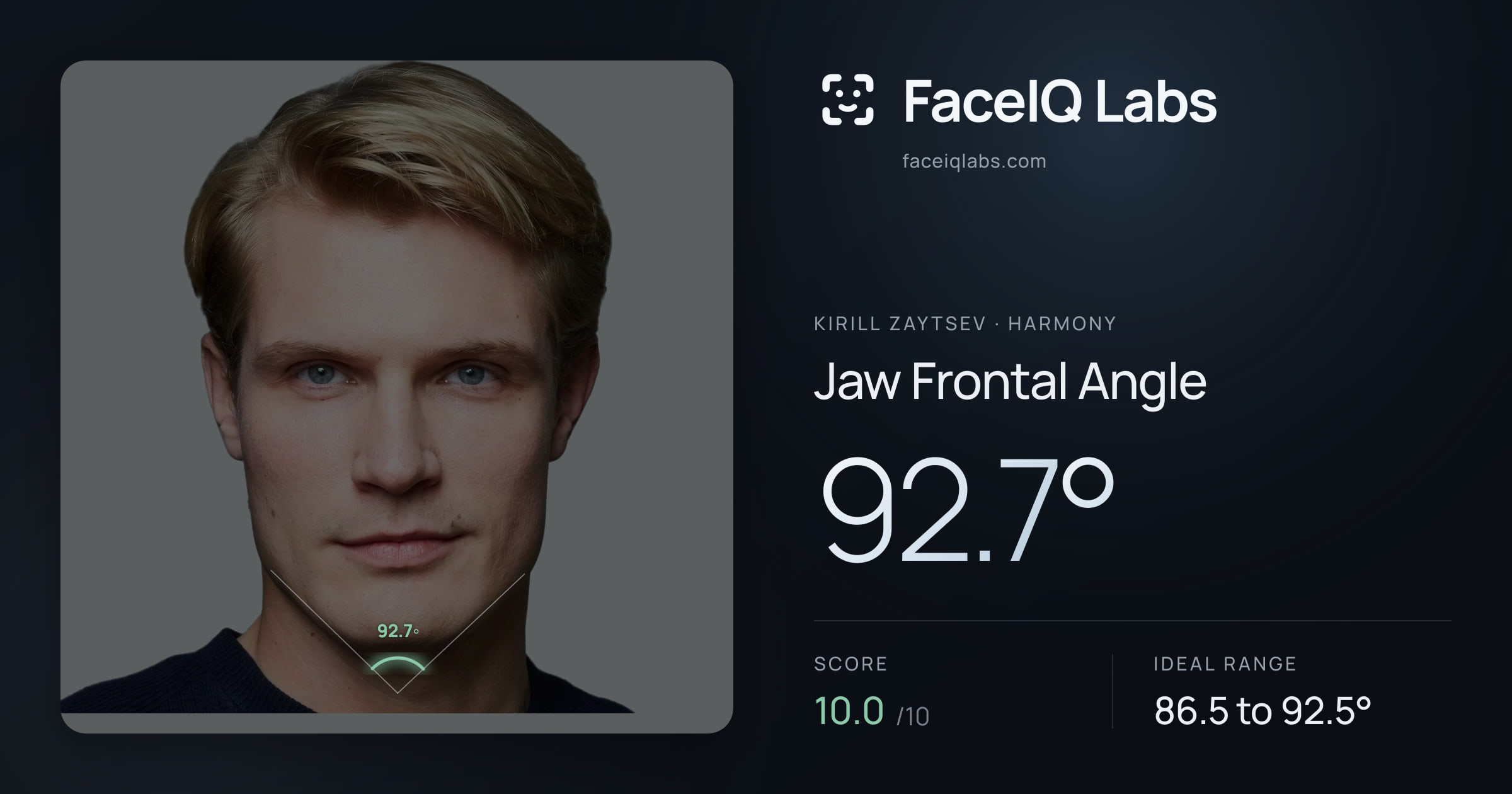 Kirill Zaytsev Jaw Frontal Angle: 92.7°, drawn on the photo