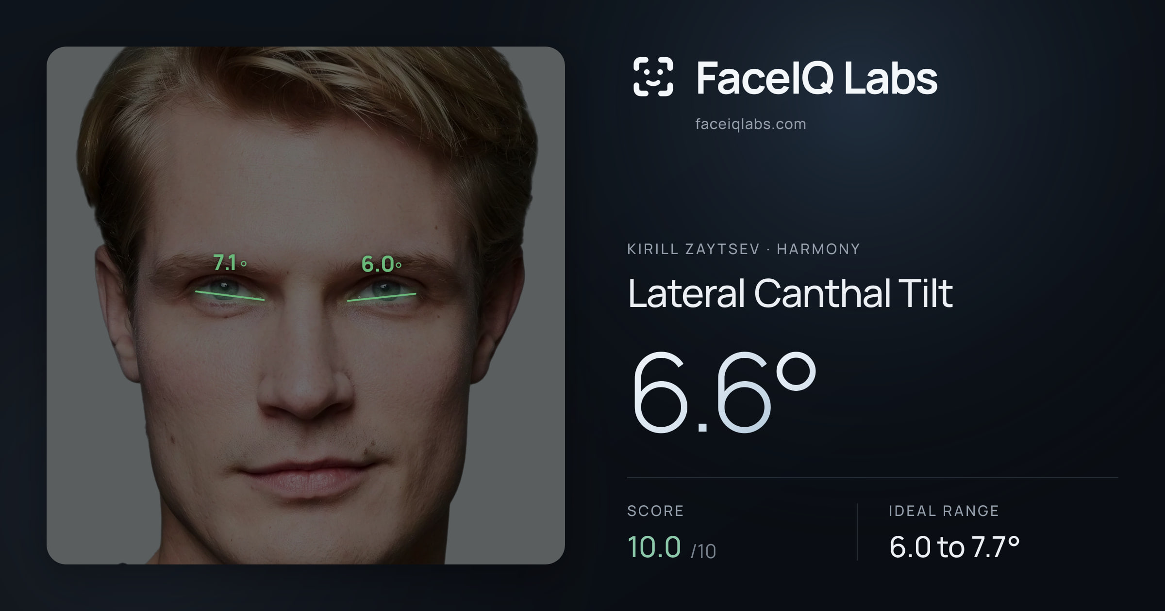 Kirill Zaytsev Lateral Canthal Tilt: 6.6°, drawn on the photo