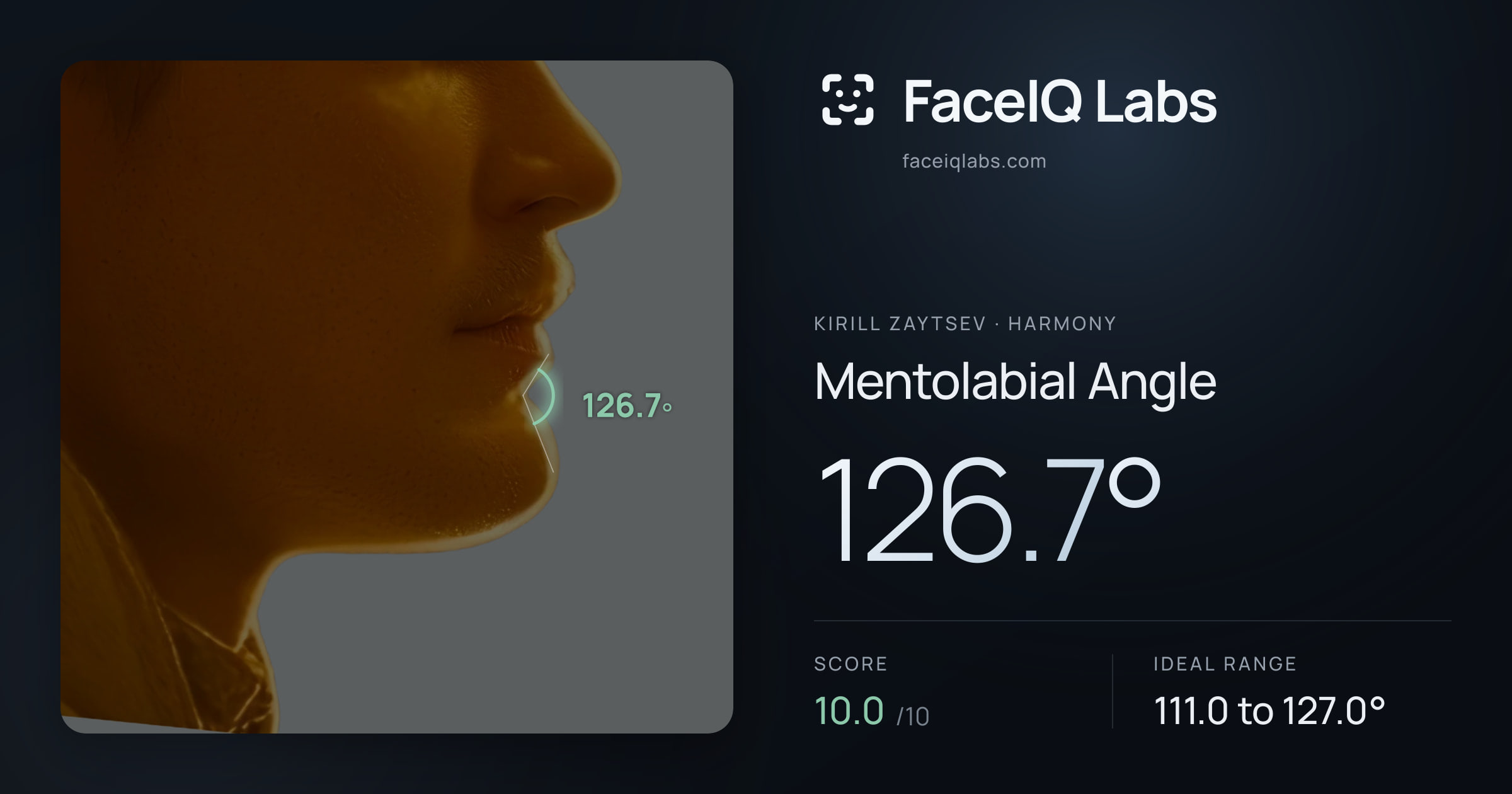 Kirill Zaytsev Mentolabial Angle: 126.7°, drawn on the photo