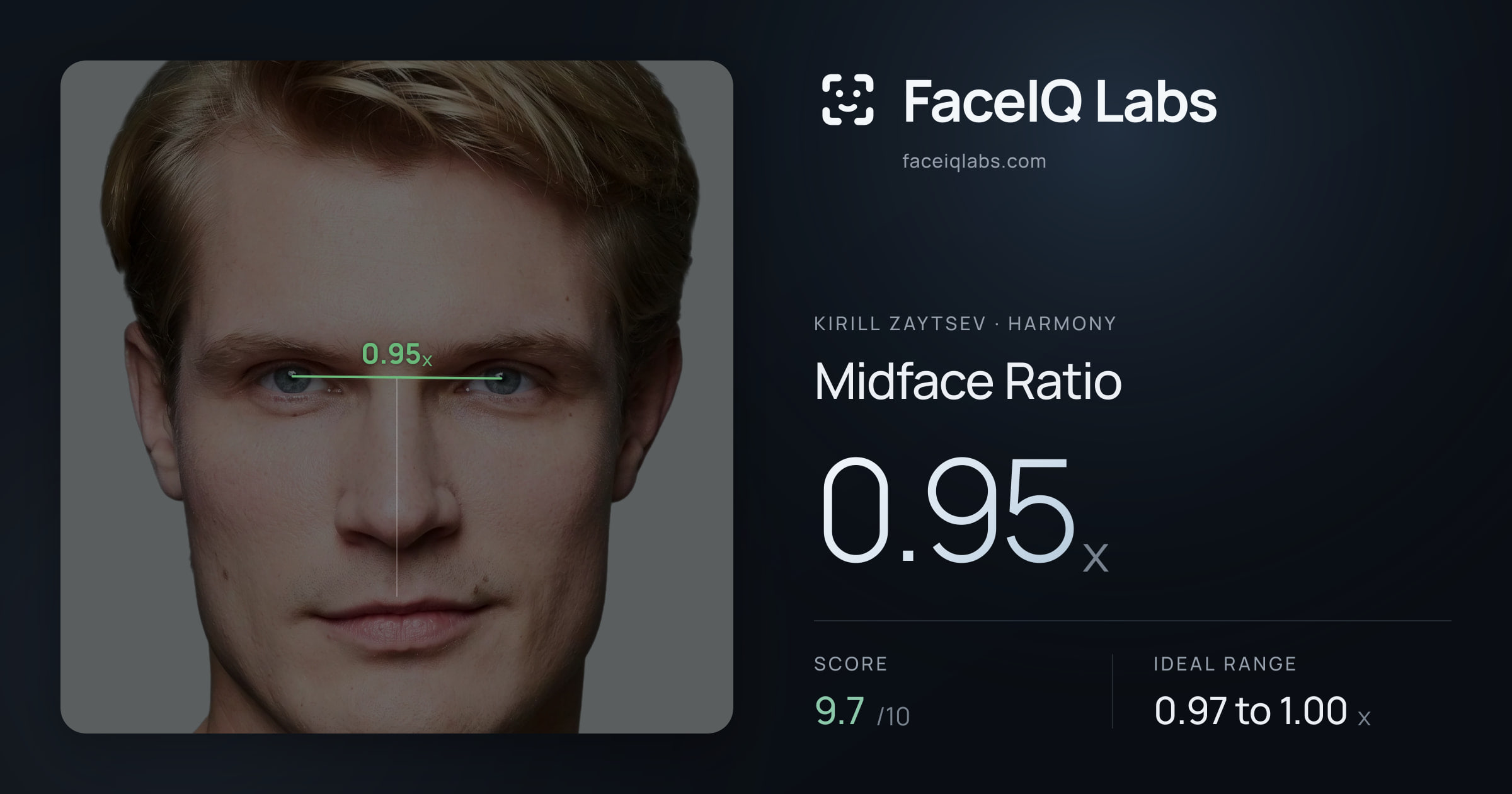 Kirill Zaytsev Midface Ratio: 0.95x, drawn on the photo