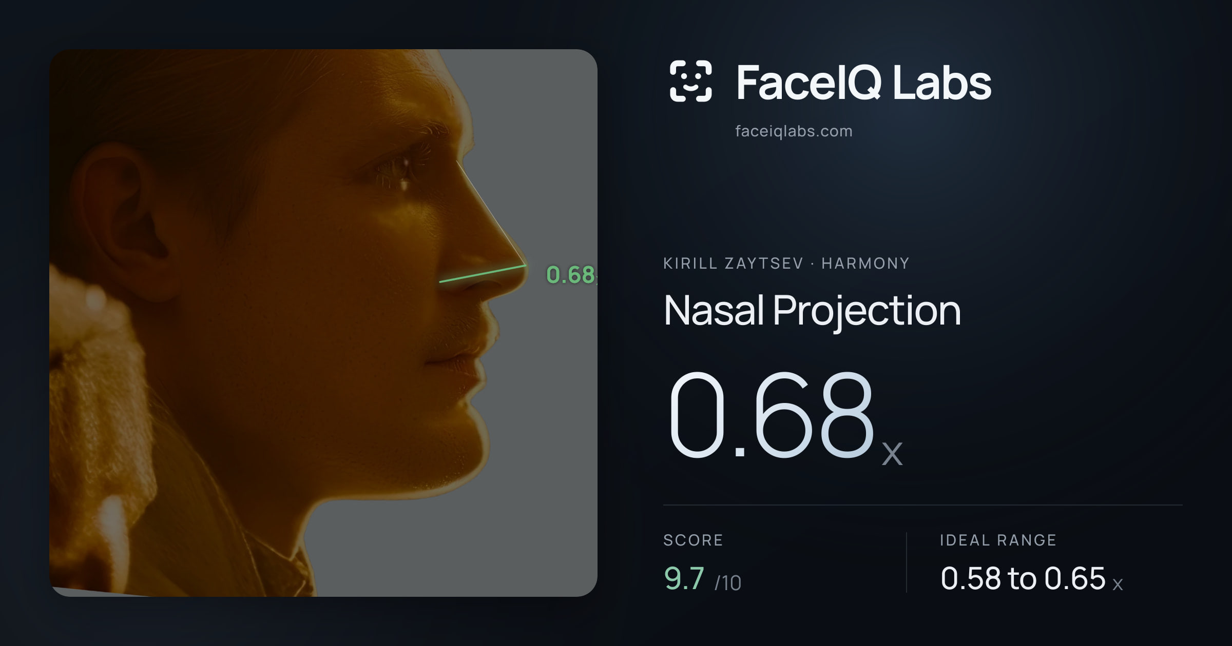 Kirill Zaytsev Nasal Projection: 0.68x, drawn on the photo