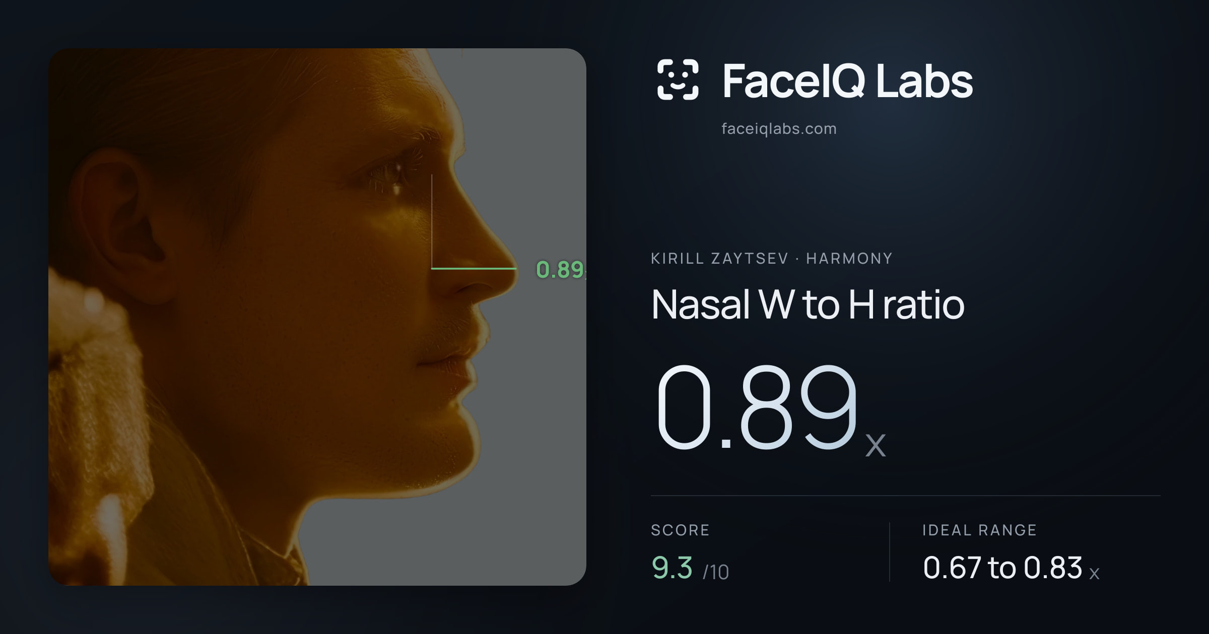 Kirill Zaytsev Nasal W to H ratio: 0.89x, drawn on the photo