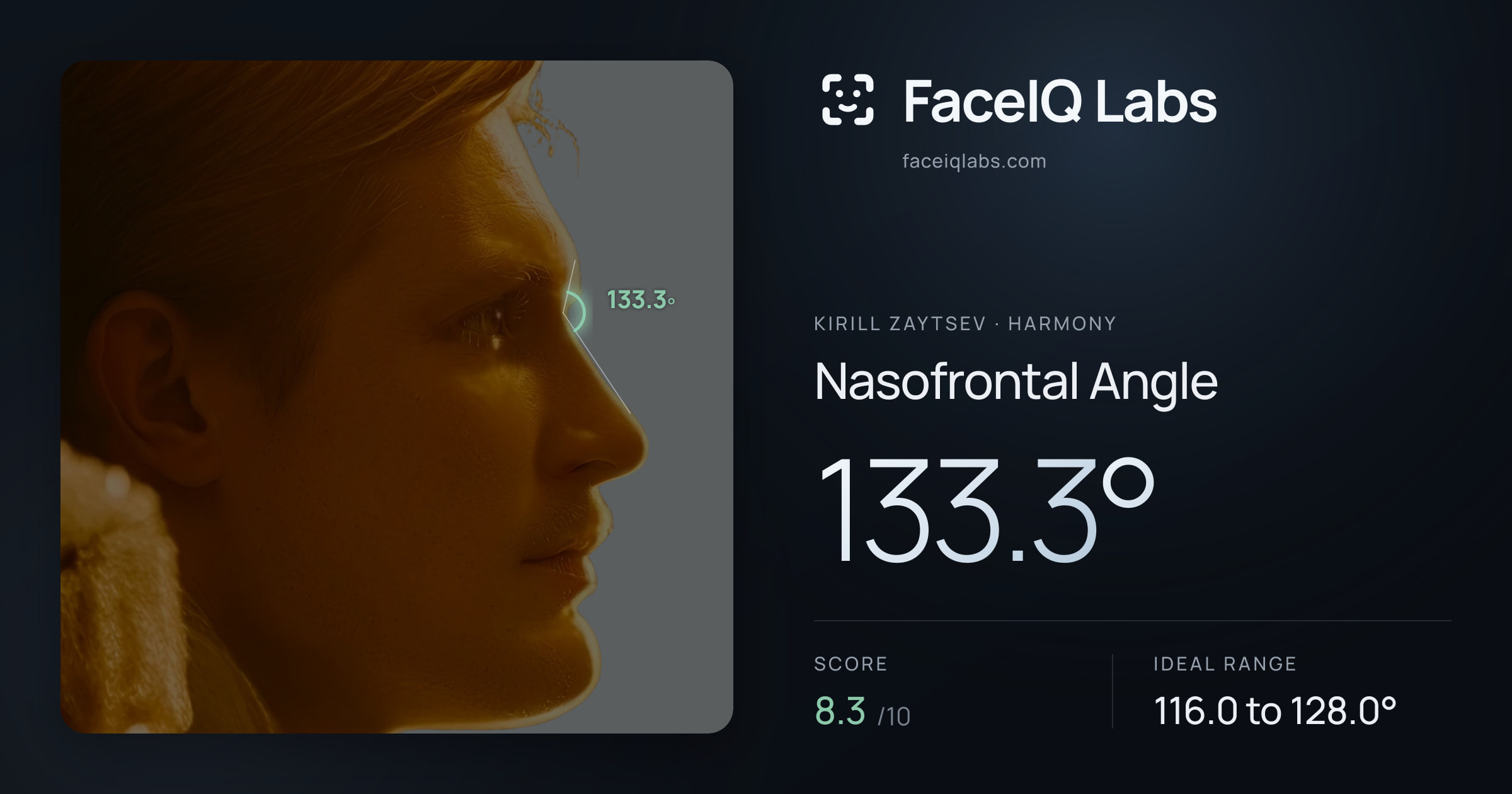 Kirill Zaytsev Nasofrontal Angle: 133.3°, drawn on the photo
