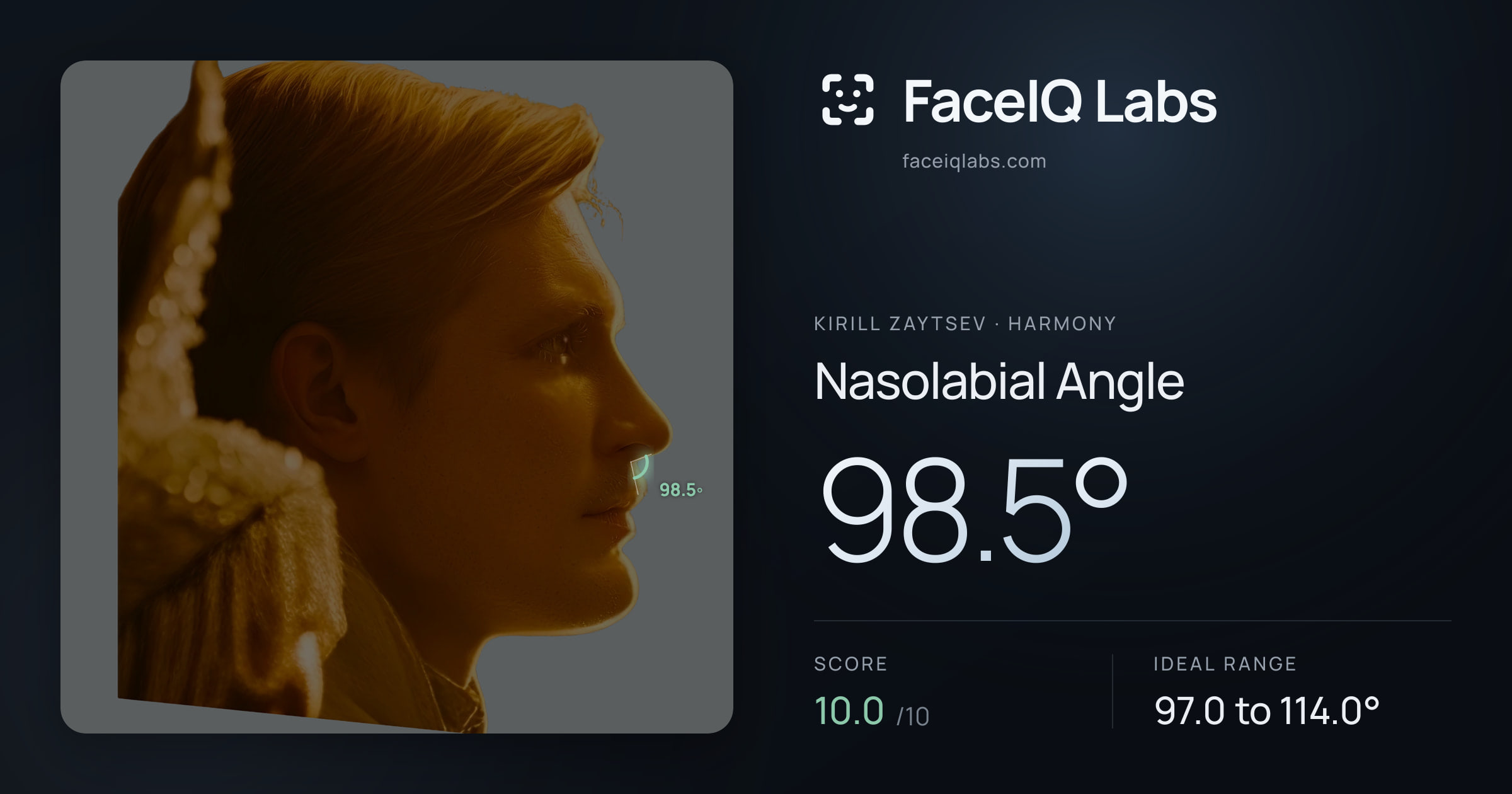 Kirill Zaytsev Nasolabial Angle: 98.5°, drawn on the photo