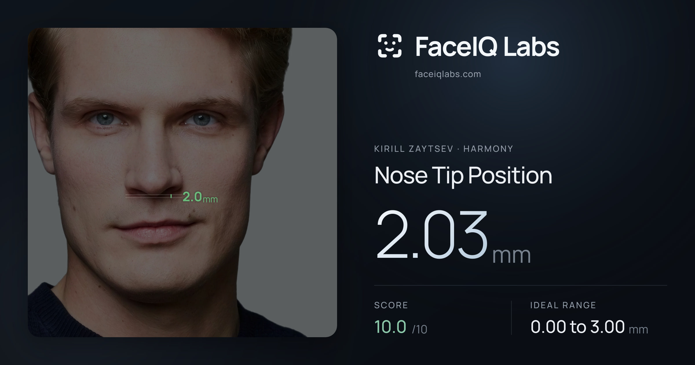 Kirill Zaytsev Nose Tip Position: 2.03mm, drawn on the photo
