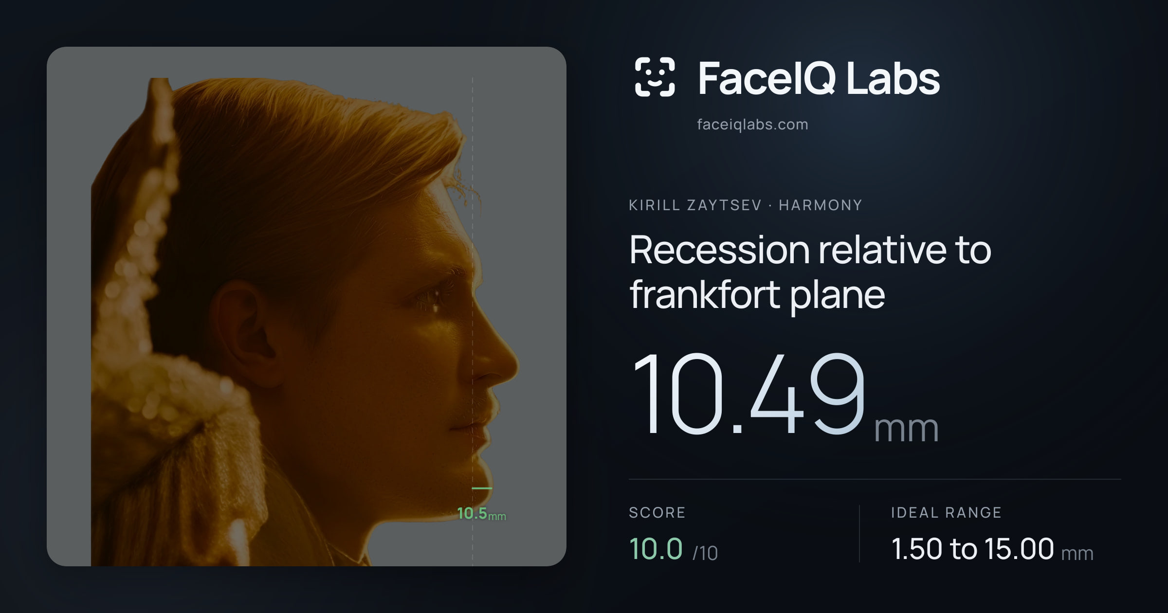 Kirill Zaytsev Recession relative to frankfort plane: 10.49mm, drawn on the photo