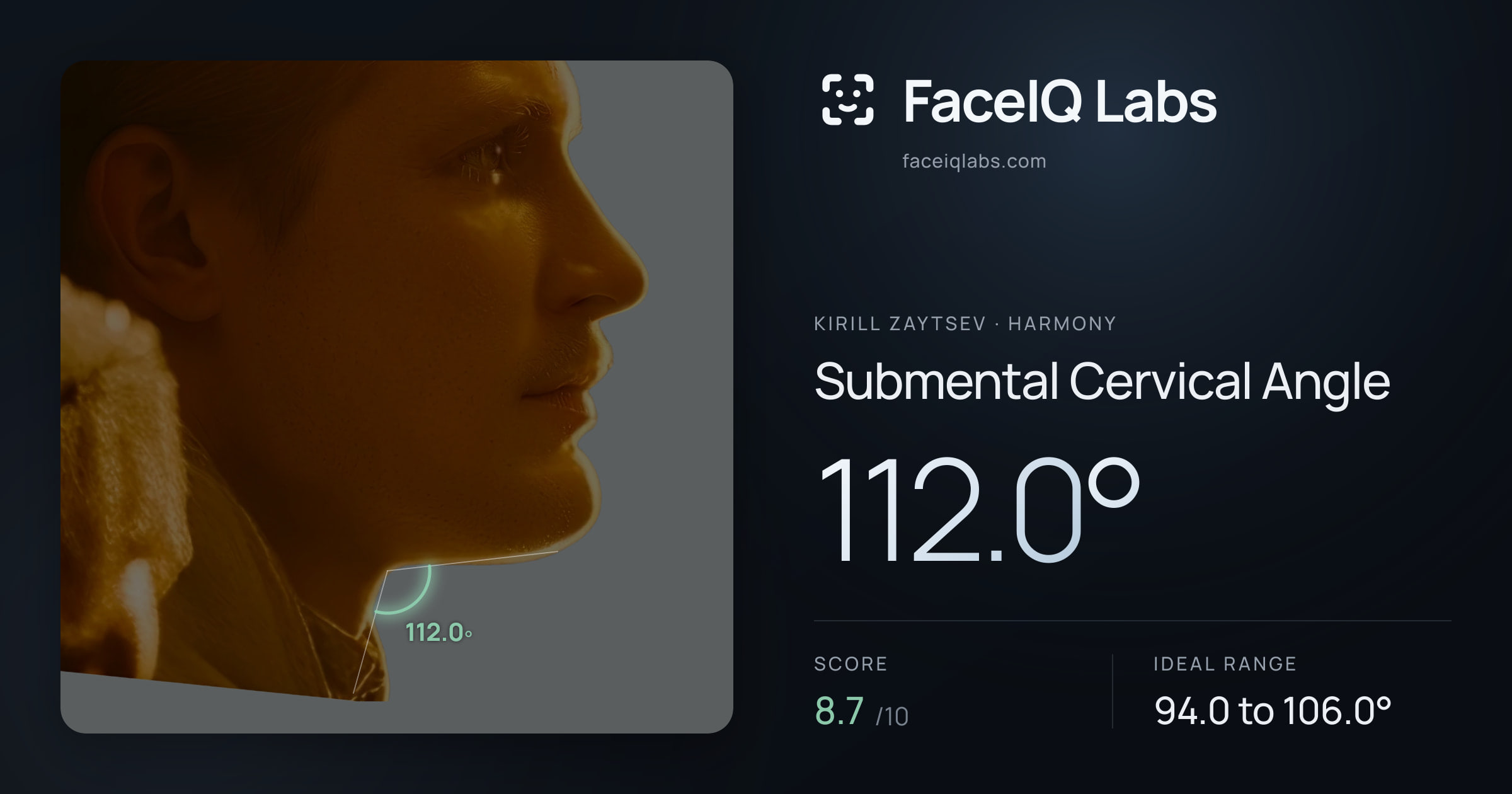 Kirill Zaytsev Submental Cervical Angle: 112.0°, drawn on the photo