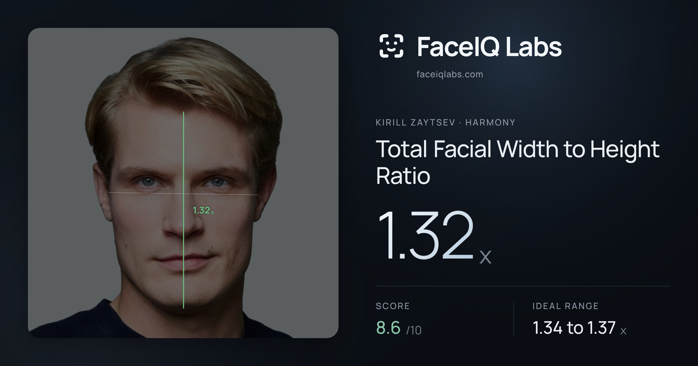Kirill Zaytsev Total Facial Width to Height Ratio: 1.32x, drawn on the photo