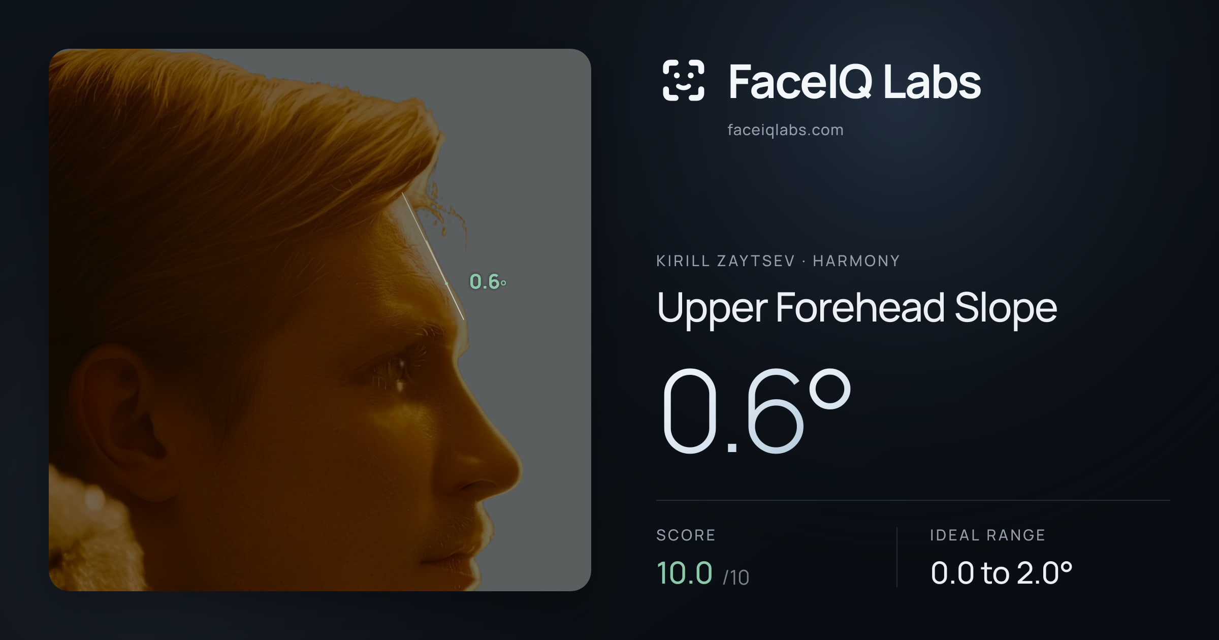 Kirill Zaytsev Upper Forehead Slope: 0.6°, drawn on the photo