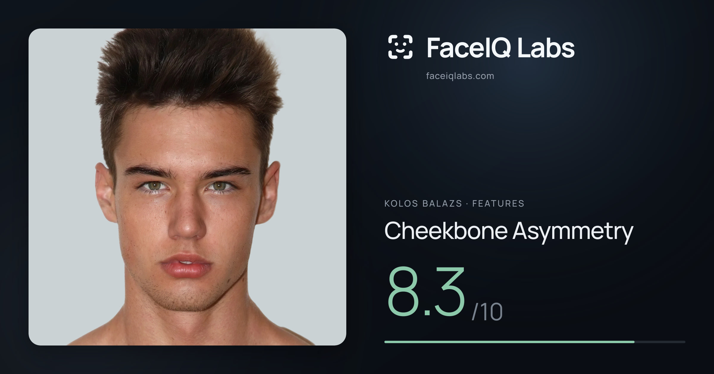 Kolos Balazs Cheekbone Asymmetry: 8.3/10, drawn on the photo