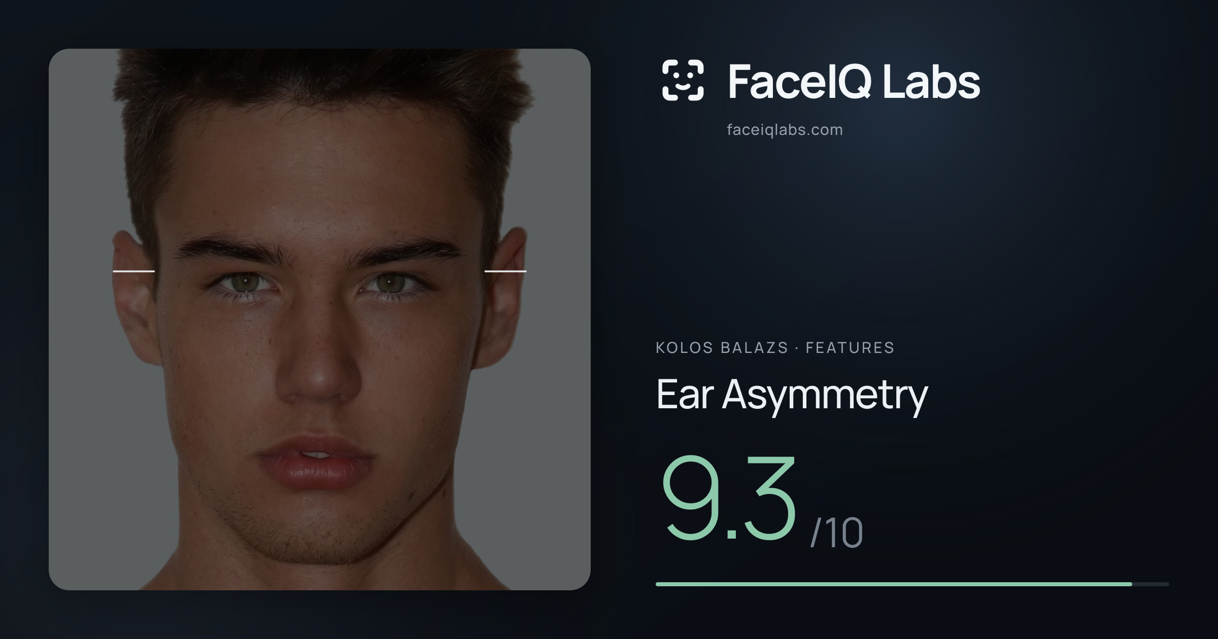 Kolos Balazs Ear Asymmetry: 9.3/10, drawn on the photo