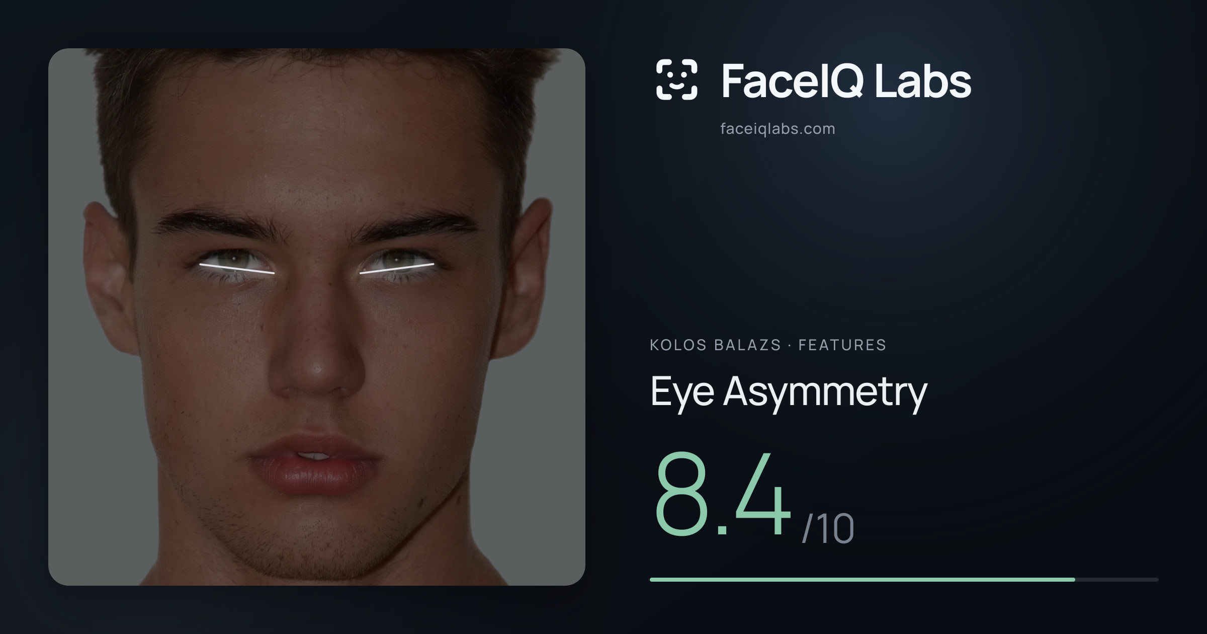 Kolos Balazs Eye Asymmetry: 8.4/10, drawn on the photo