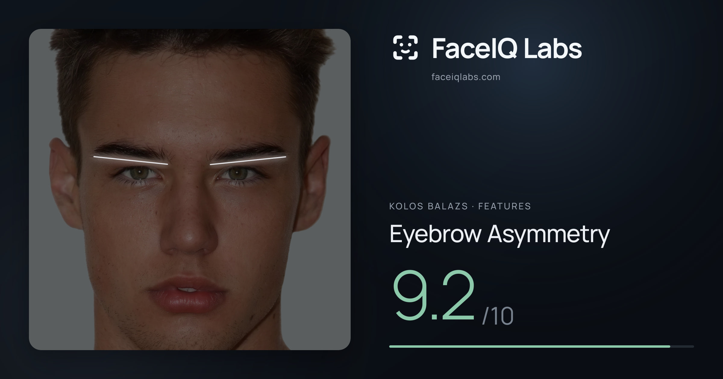 Kolos Balazs Eyebrow Asymmetry: 9.2/10, drawn on the photo