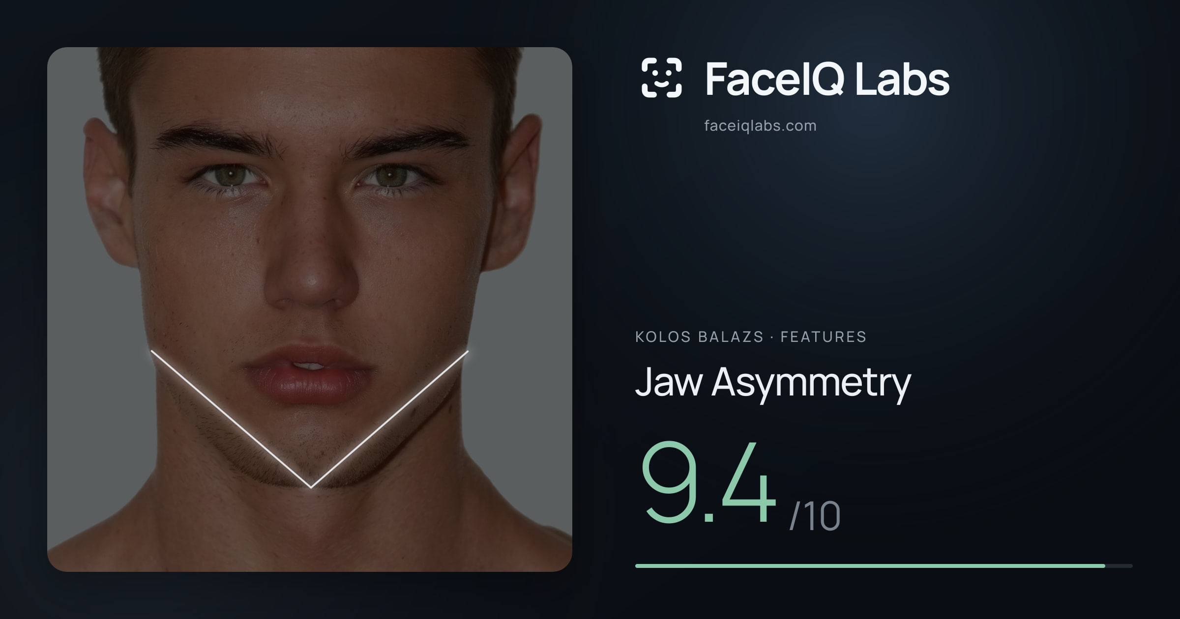 Kolos Balazs Jaw Asymmetry: 9.4/10, drawn on the photo