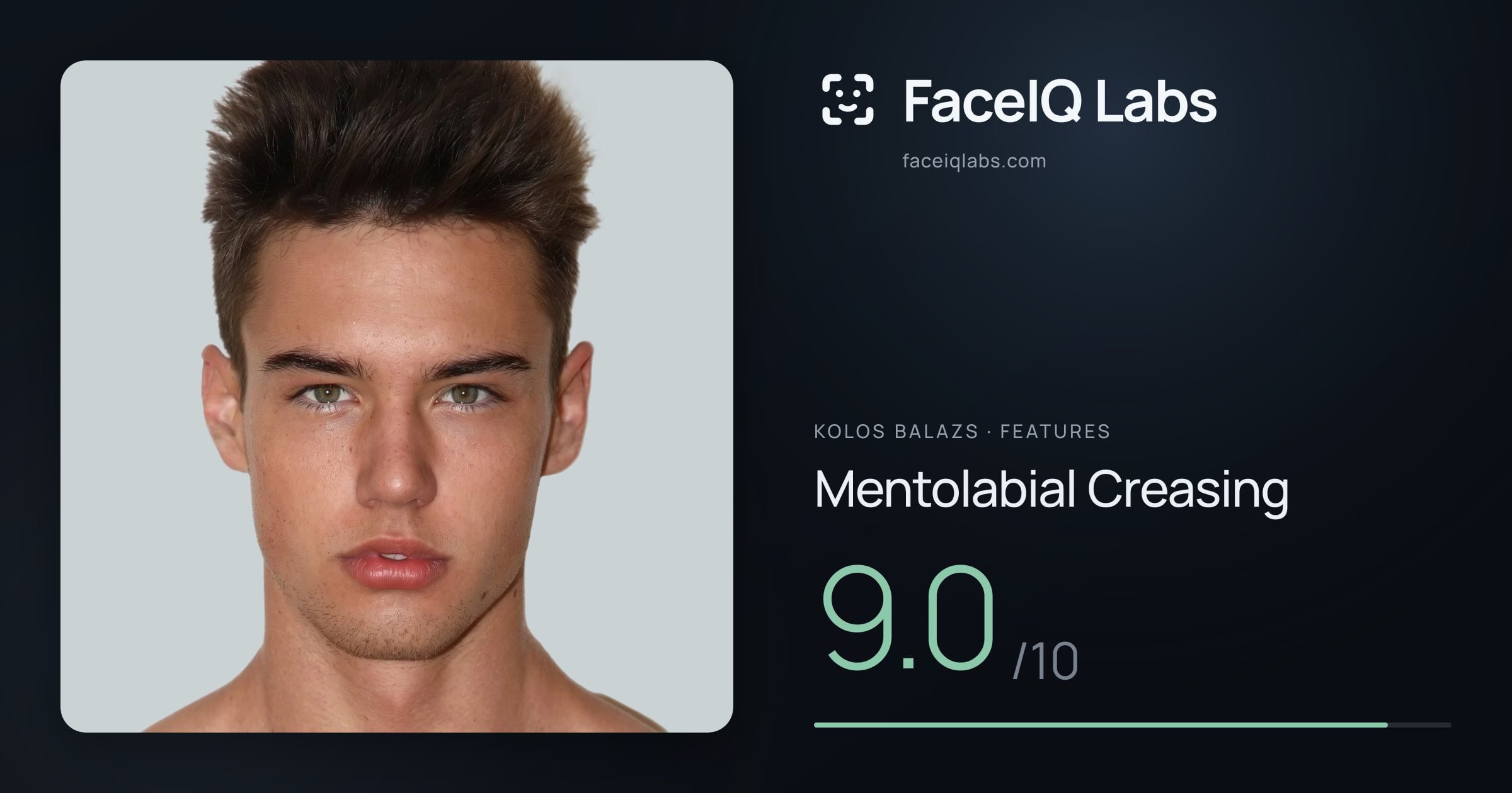Kolos Balazs Mentolabial Creasing: 9.0/10, drawn on the photo