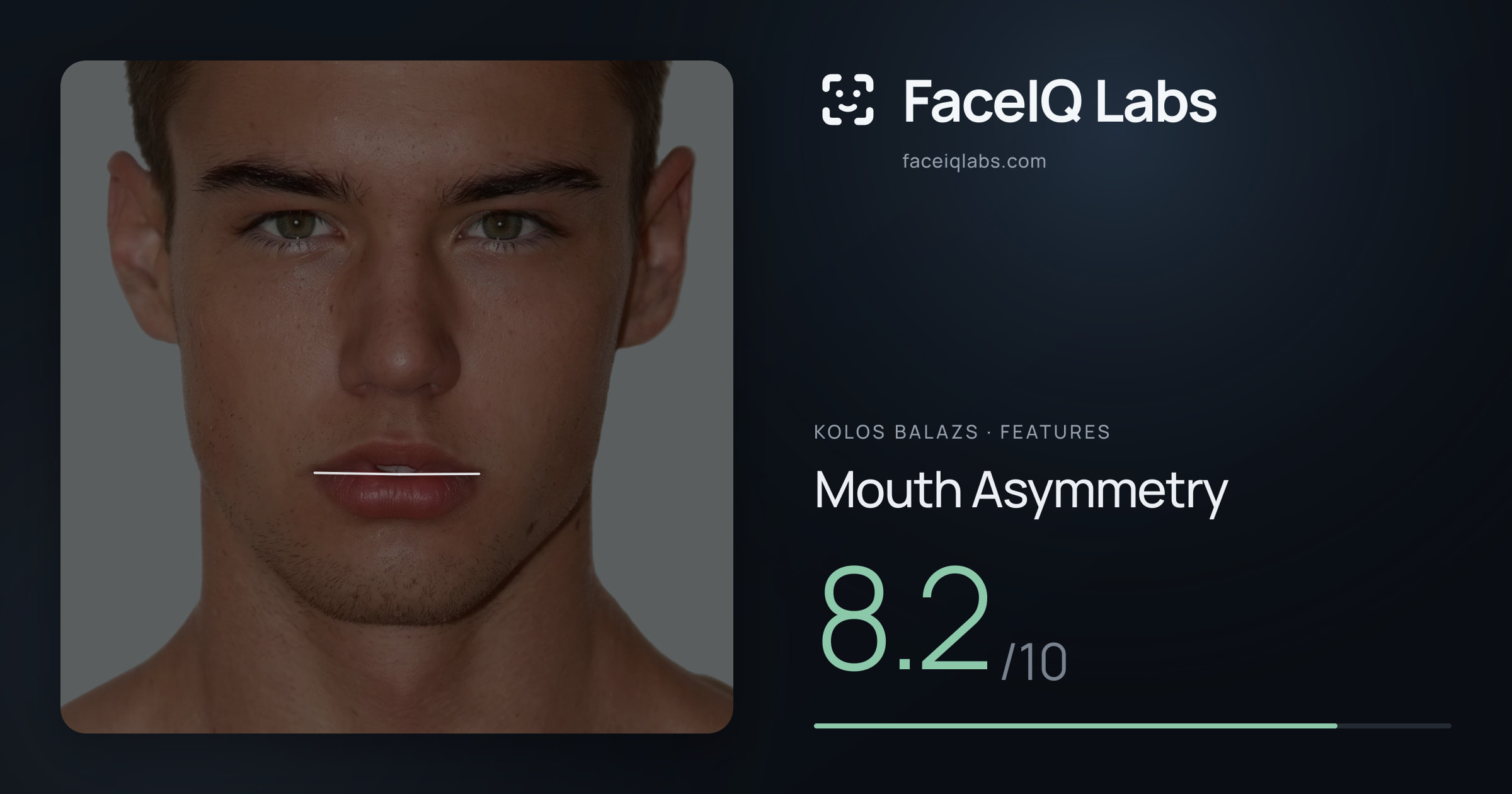 Kolos Balazs Mouth Asymmetry: 8.2/10, drawn on the photo