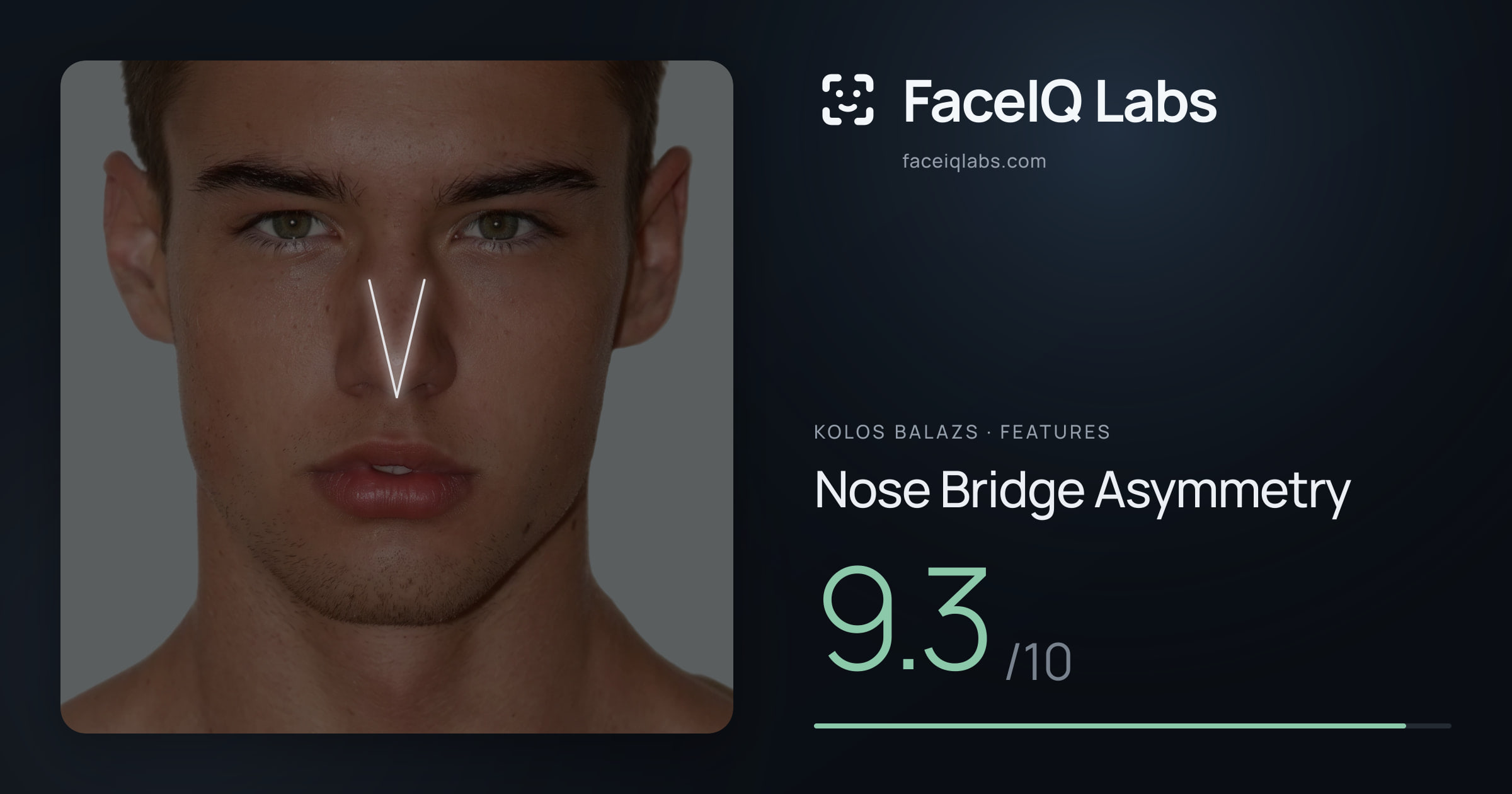 Kolos Balazs Nose Bridge Asymmetry: 9.3/10, drawn on the photo