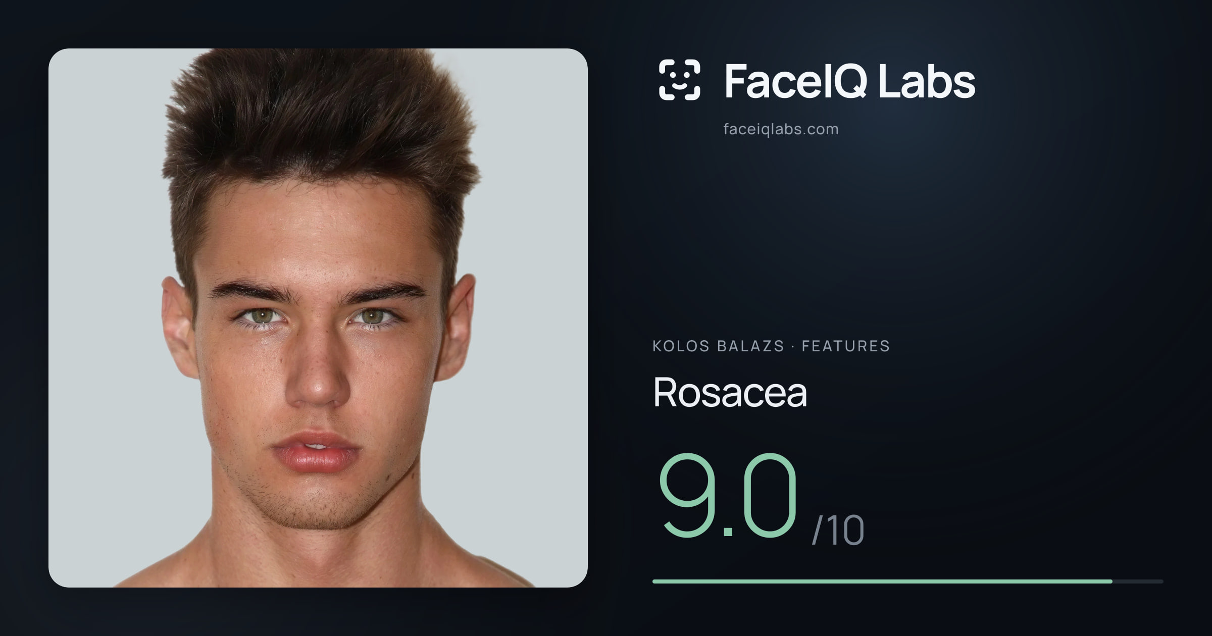 Kolos Balazs Rosacea: 9.0/10, drawn on the photo