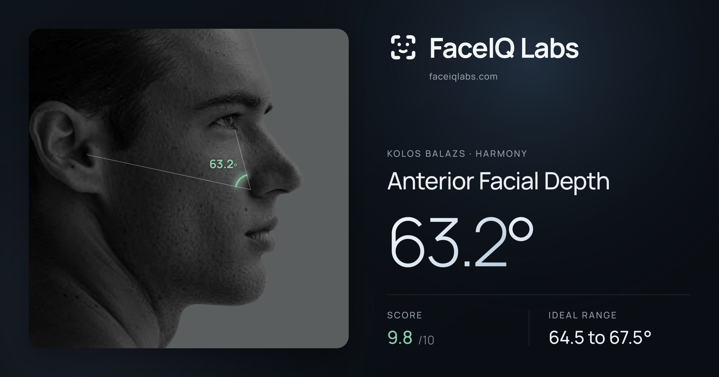 Kolos Balazs Anterior Facial Depth: 63.2°, drawn on the photo