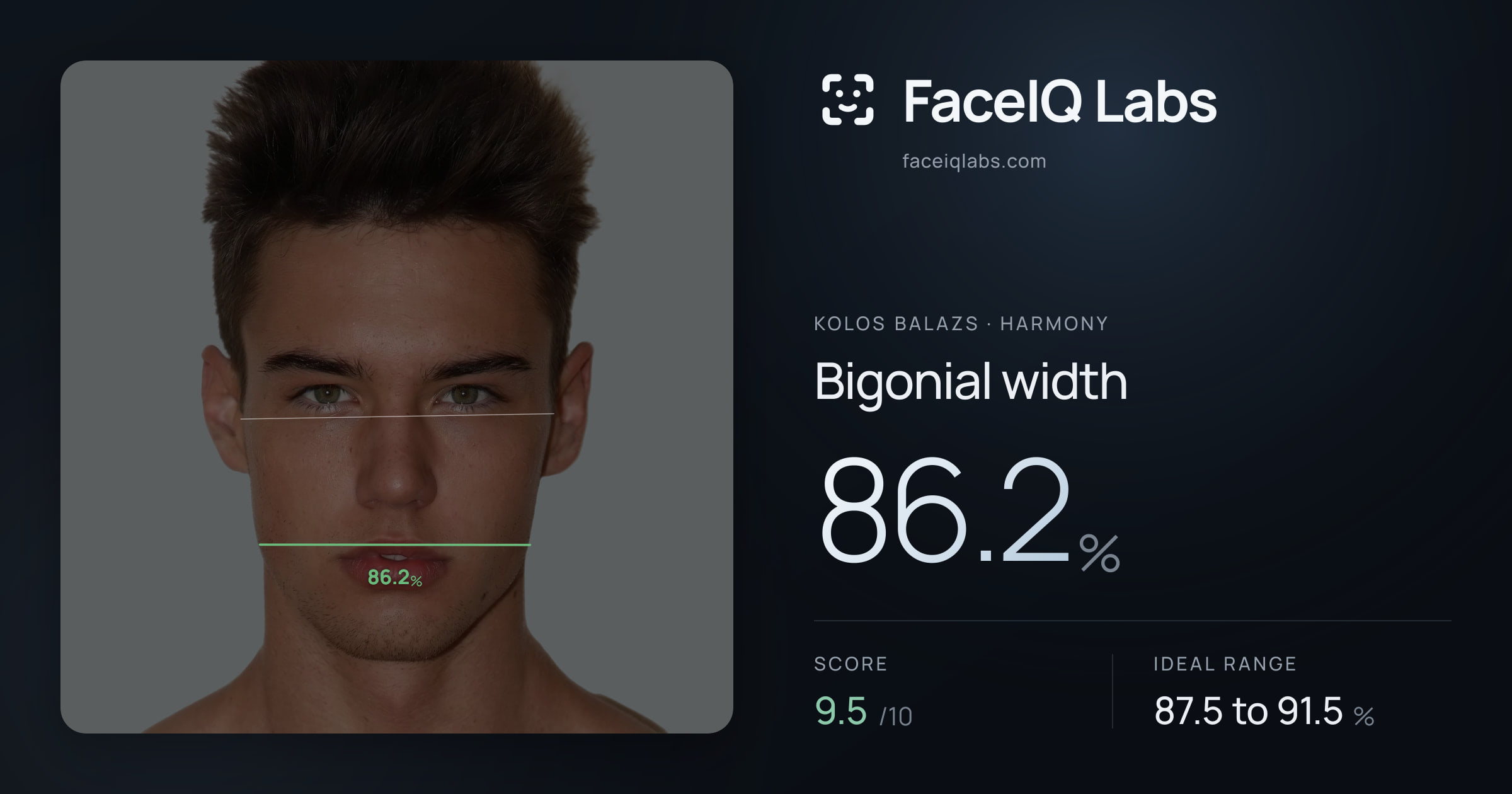 Kolos Balazs Bigonial width: 86.2%, drawn on the photo