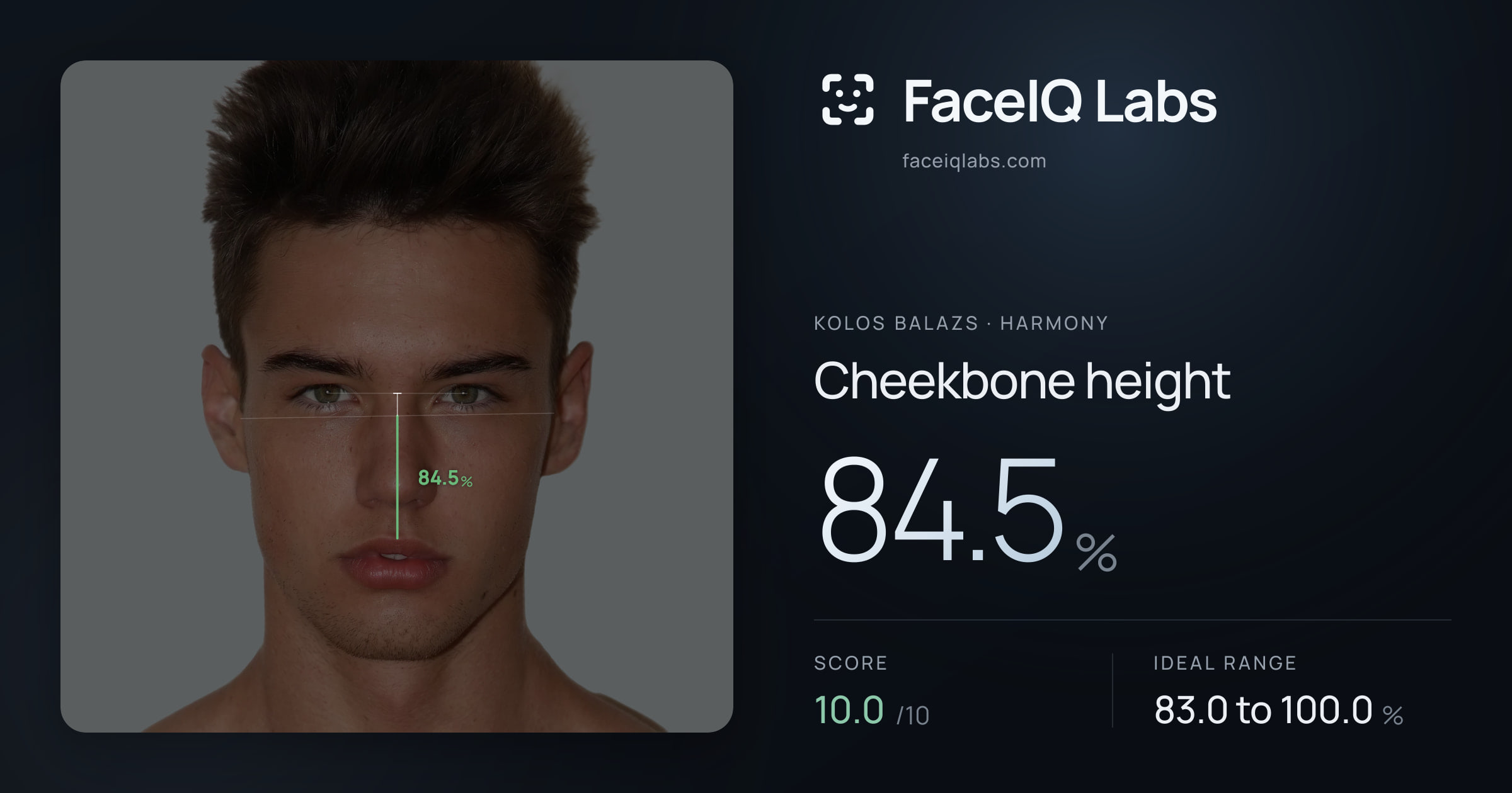 Kolos Balazs Cheekbone height: 84.5%, drawn on the photo