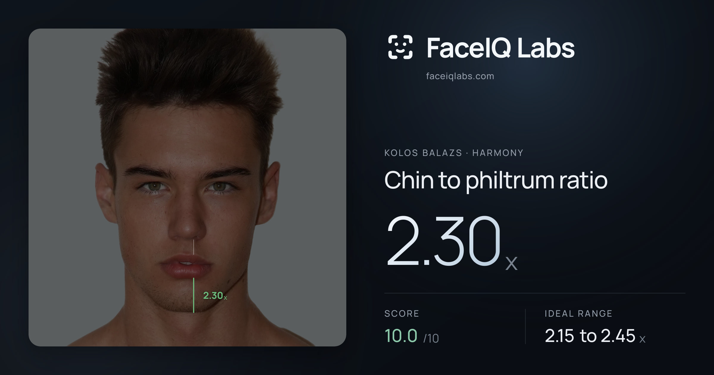 Kolos Balazs Chin to philtrum ratio: 2.30x, drawn on the photo