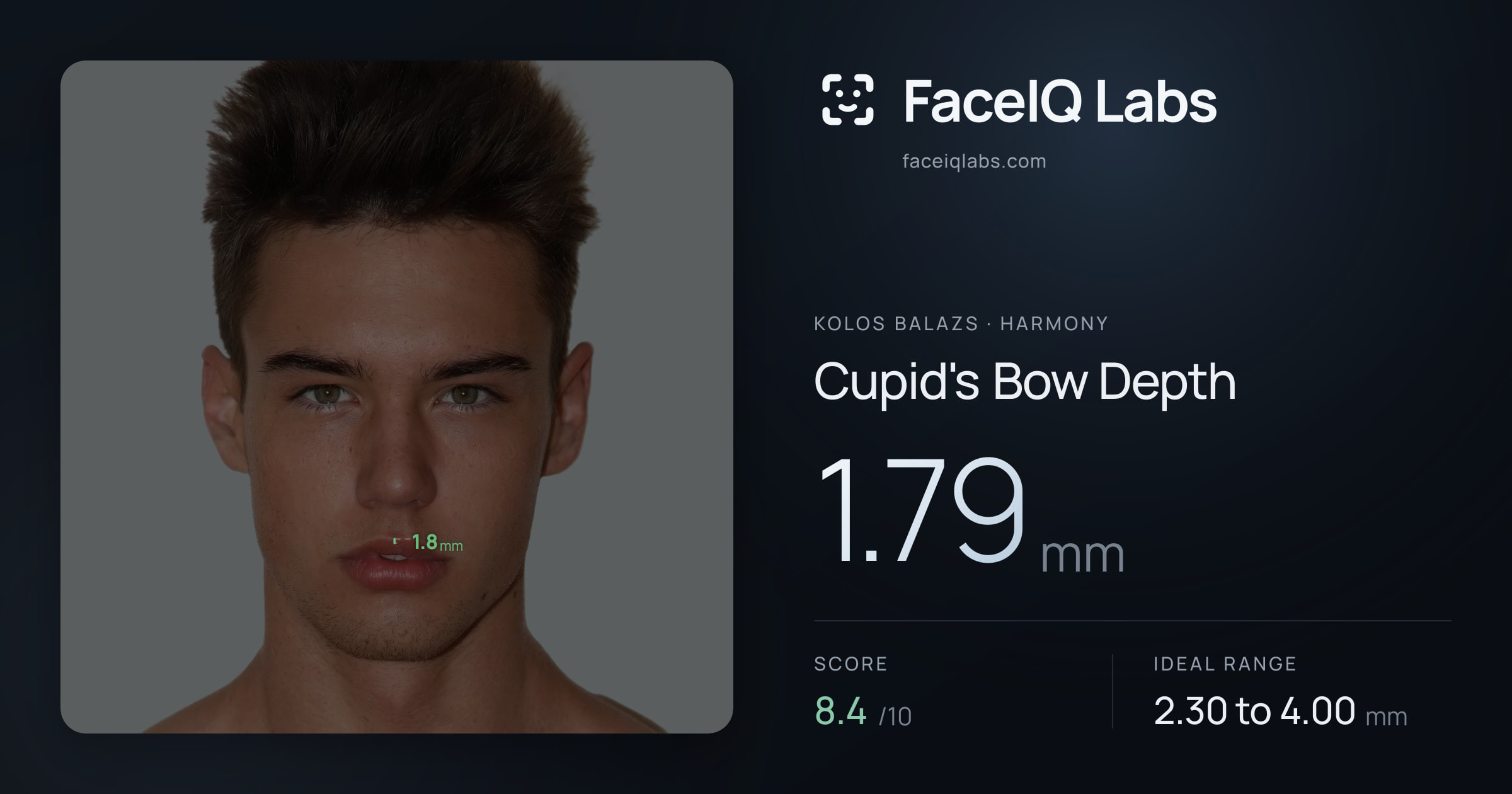 Kolos Balazs Cupid's Bow Depth: 1.79mm, drawn on the photo