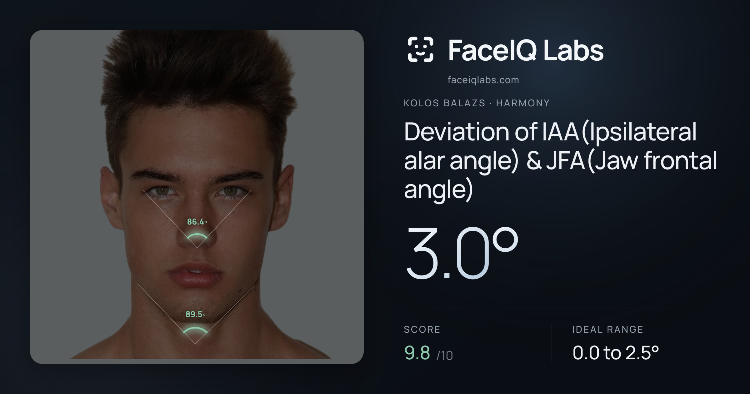 Kolos Balazs Deviation of IAA(Ipsilateral alar angle) & JFA(Jaw frontal angle): 3.0°, drawn on the photo