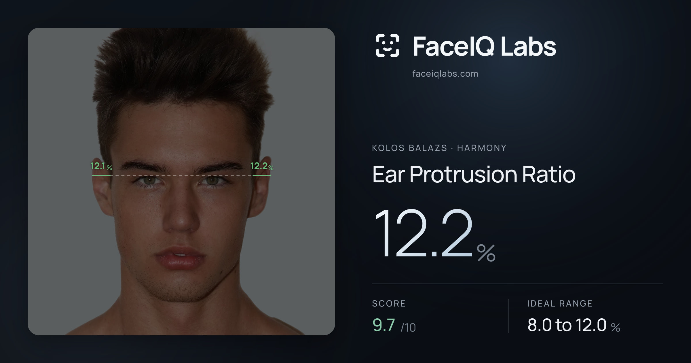 Kolos Balazs Ear Protrusion Ratio: 12.2%, drawn on the photo