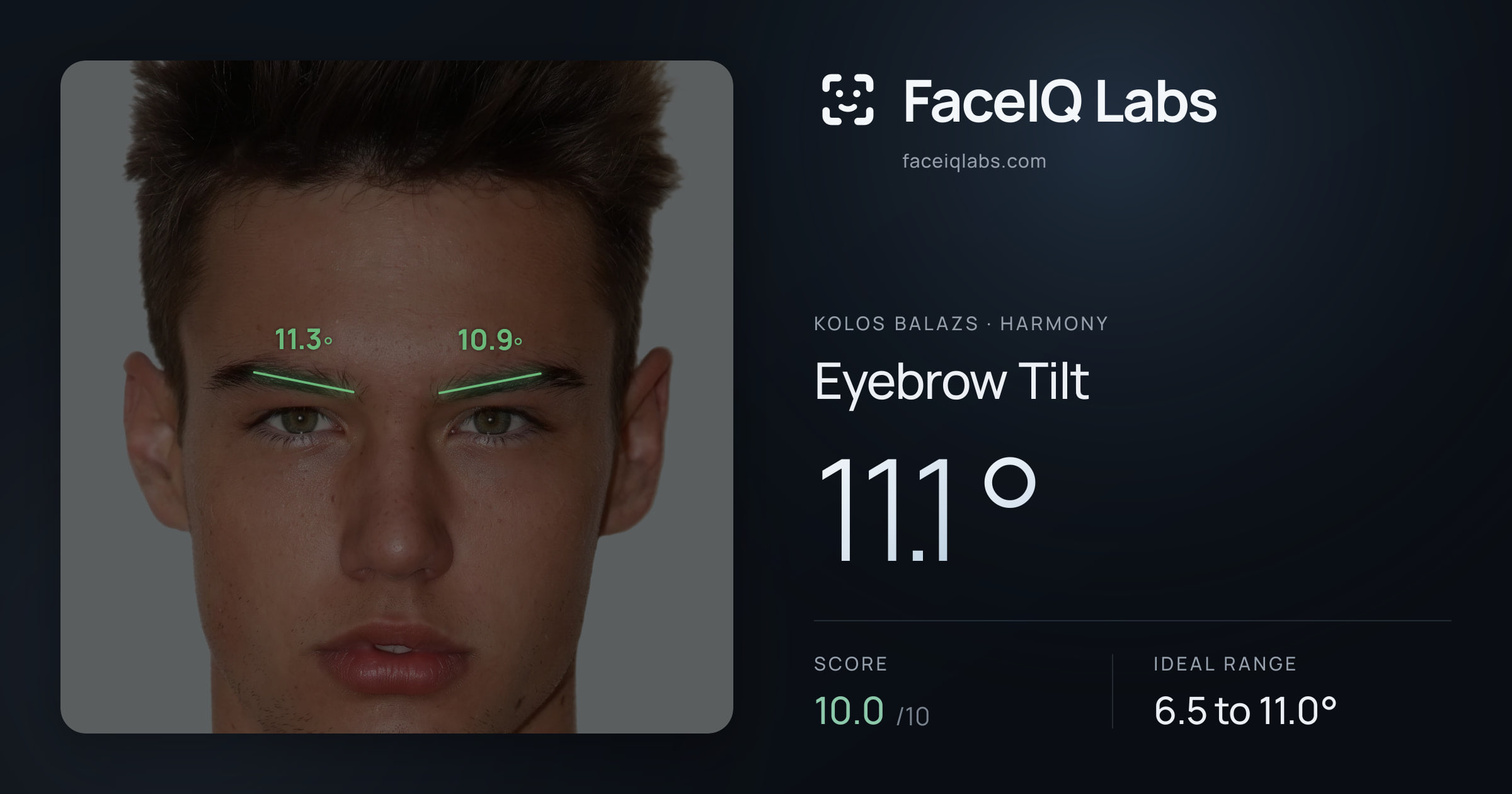 Kolos Balazs Eyebrow Tilt: 11.1°, drawn on the photo
