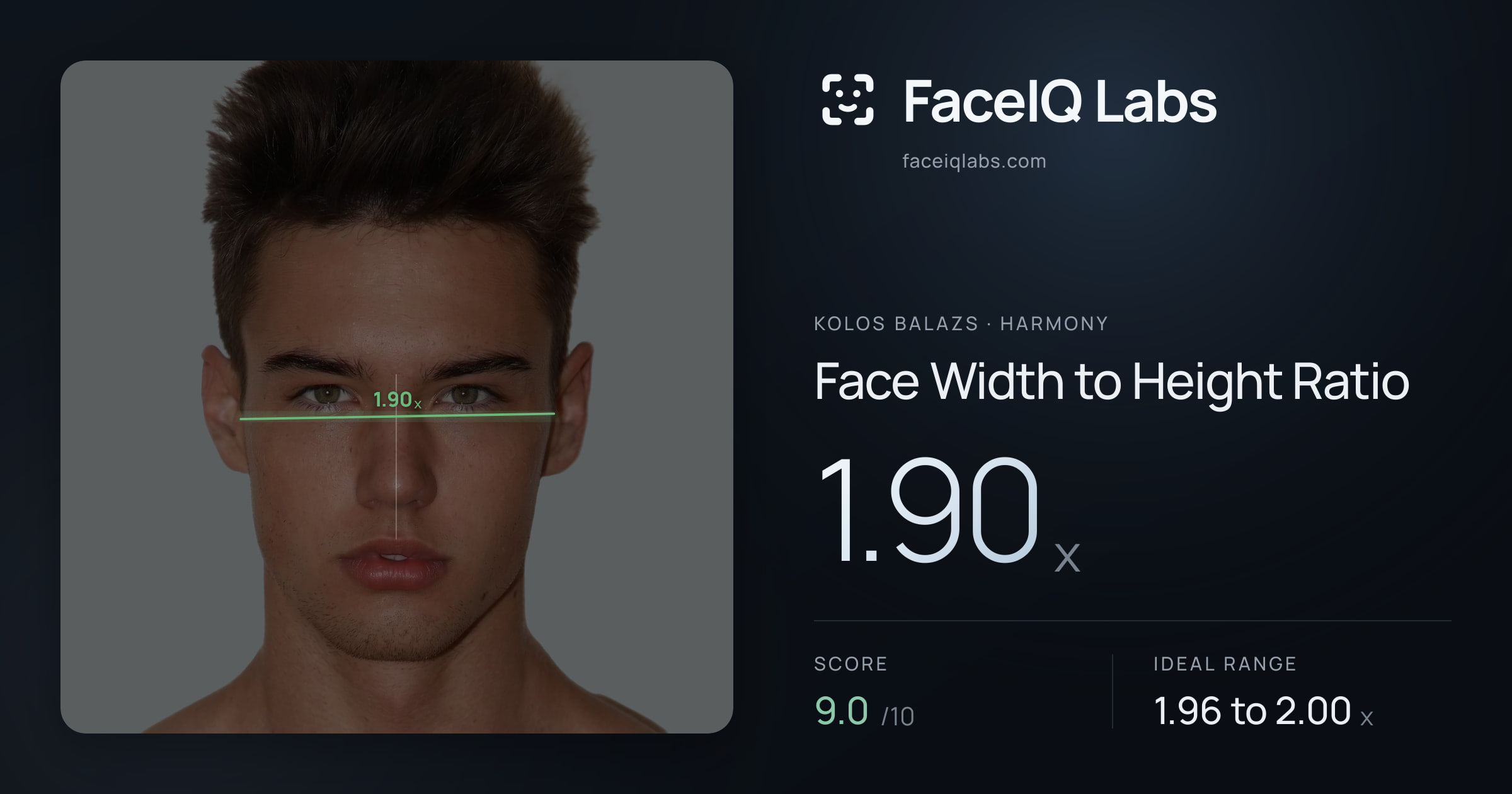 Kolos Balazs Face Width to Height Ratio: 1.90x, drawn on the photo