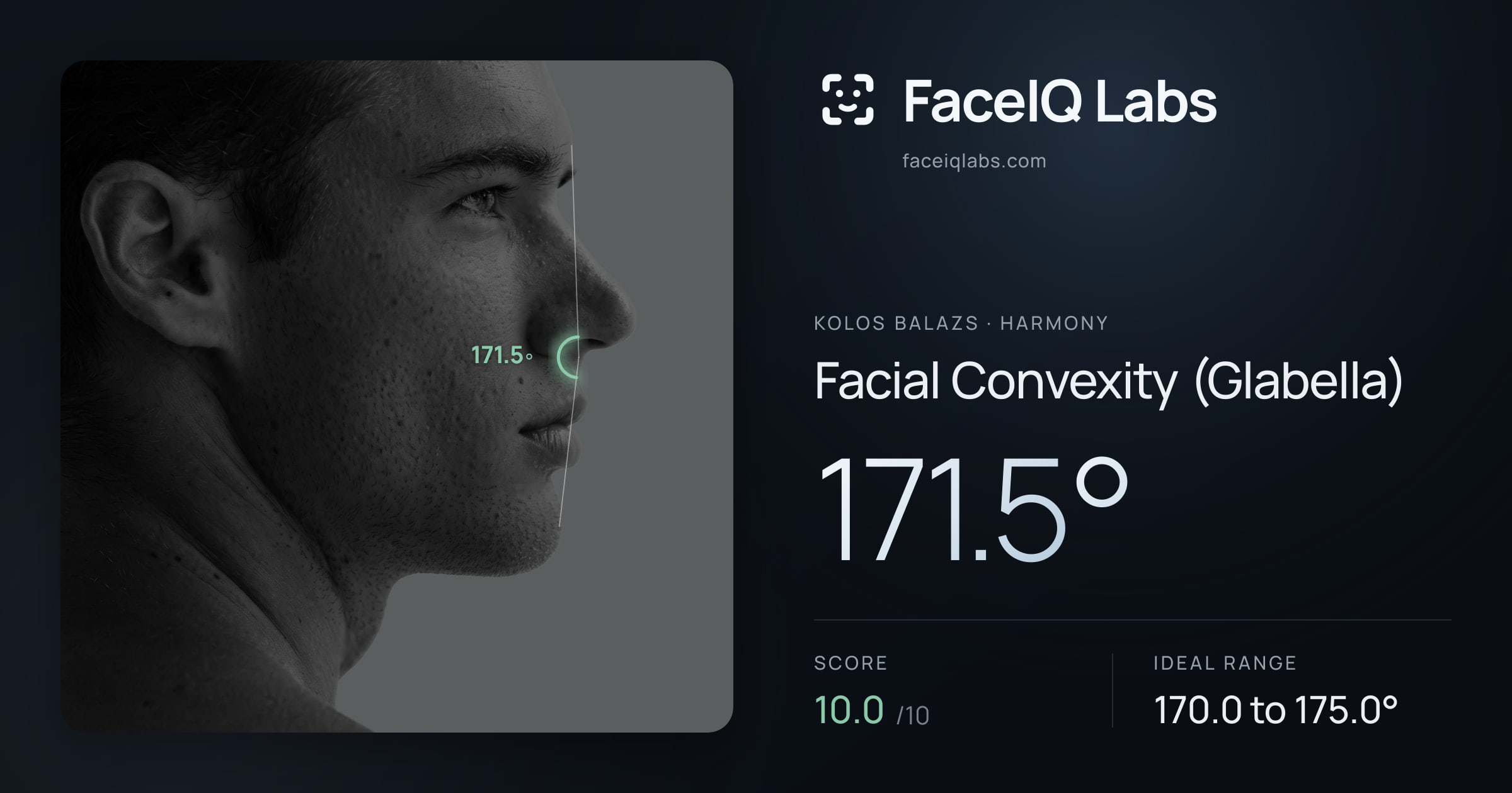 Kolos Balazs Facial Convexity (Glabella): 171.5°, drawn on the photo