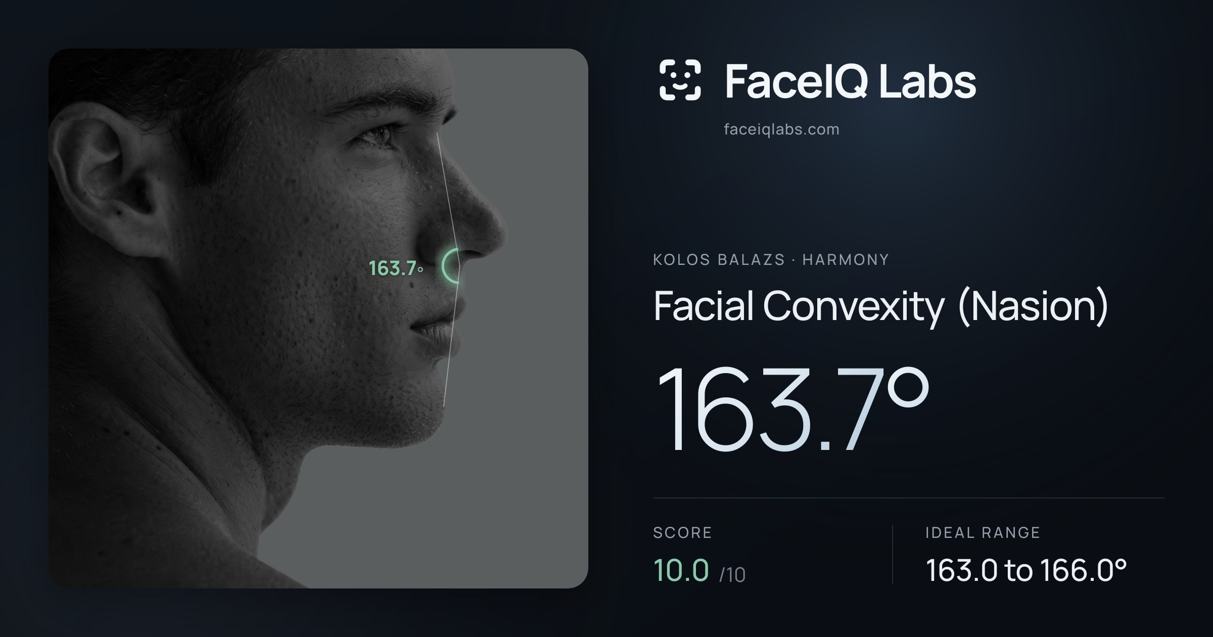 Kolos Balazs Facial Convexity (Nasion): 163.7°, drawn on the photo