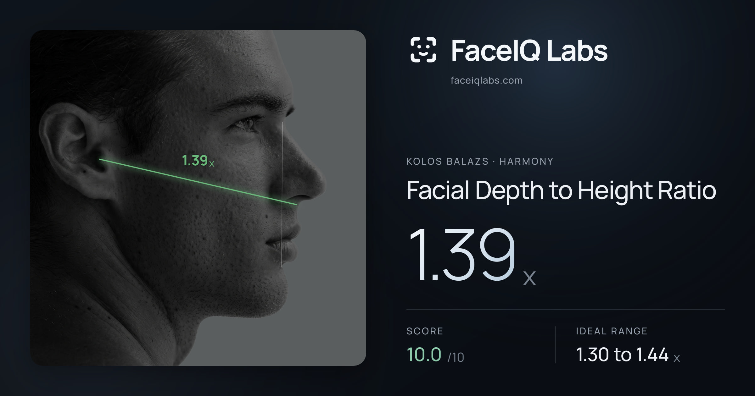 Kolos Balazs Facial Depth to Height Ratio: 1.39x, drawn on the photo