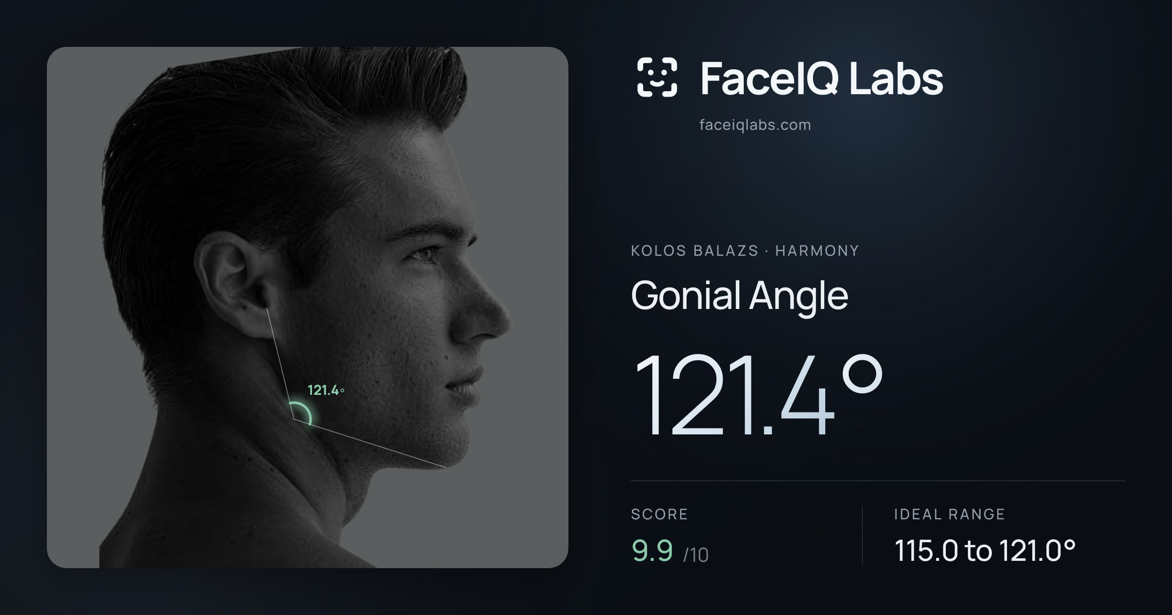 Kolos Balazs Gonial Angle: 121.4°, drawn on the photo