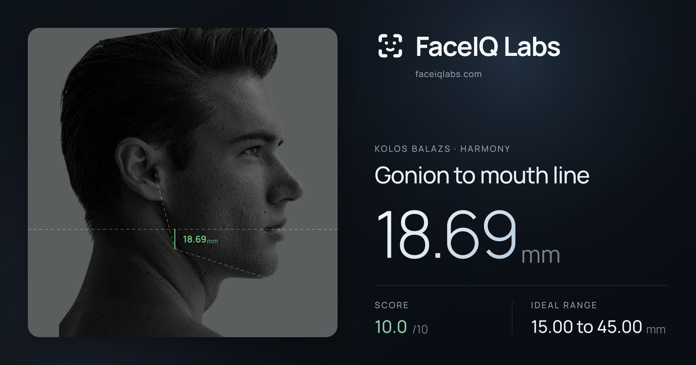 Kolos Balazs Gonion to mouth line: 18.69mm, drawn on the photo