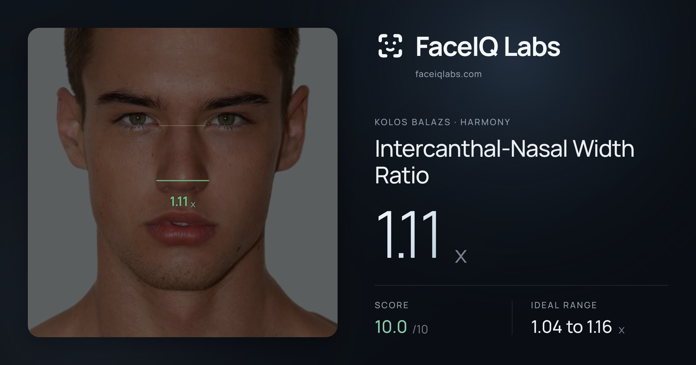 Kolos Balazs Intercanthal-Nasal Width Ratio: 1.11x, drawn on the photo